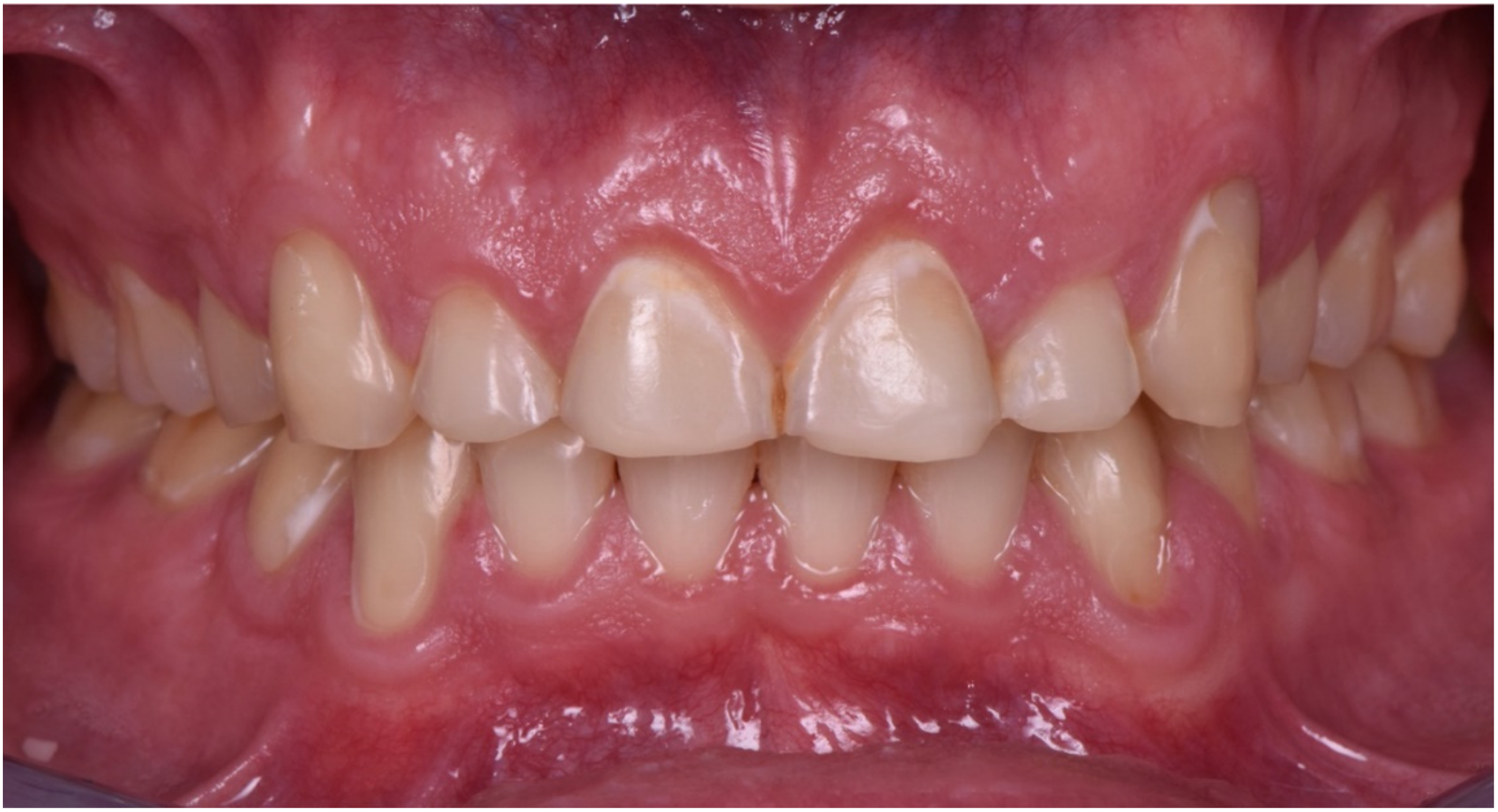 Dentistry 10 00051 g005