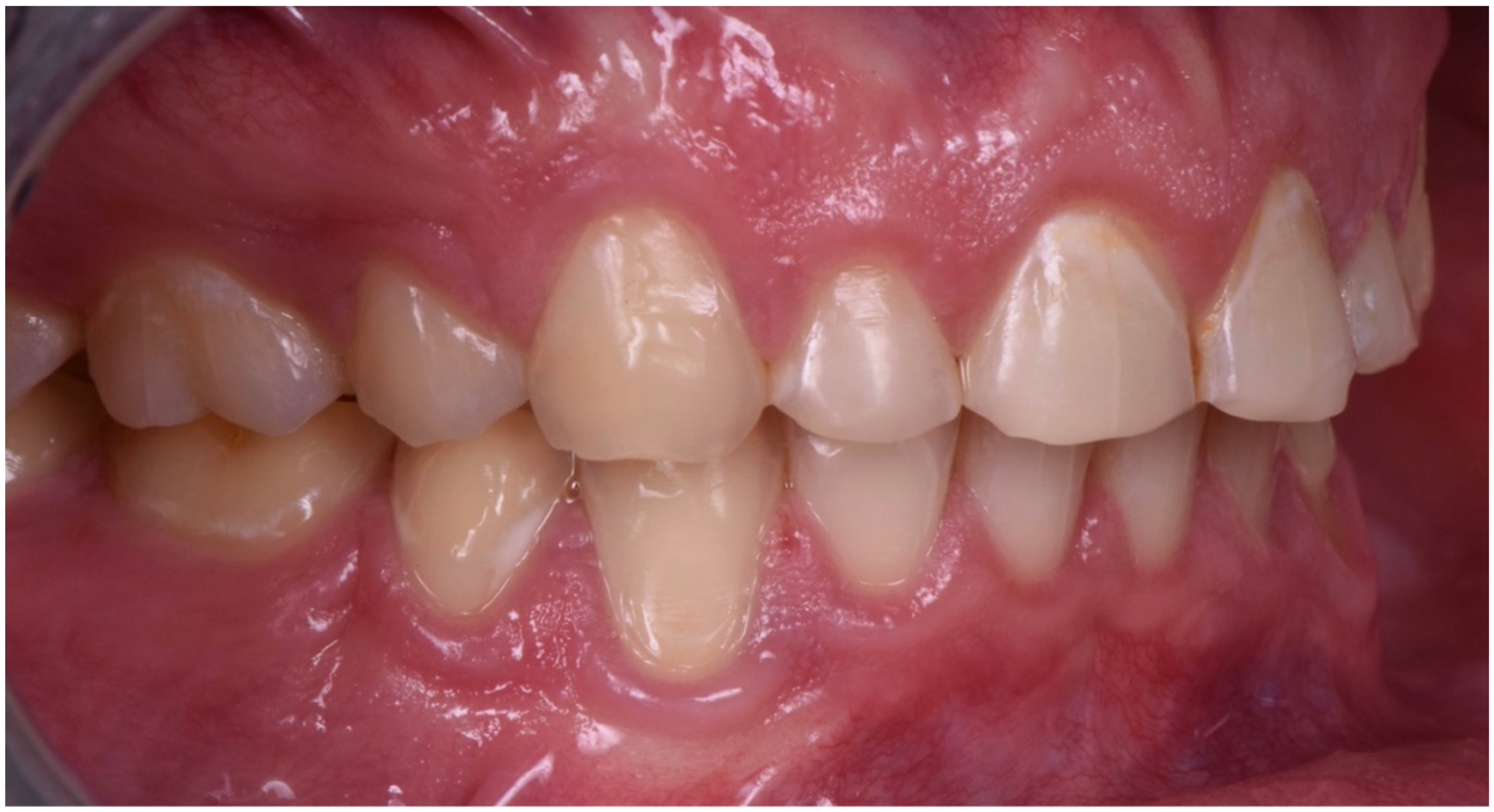 Dentistry 10 00051 g006