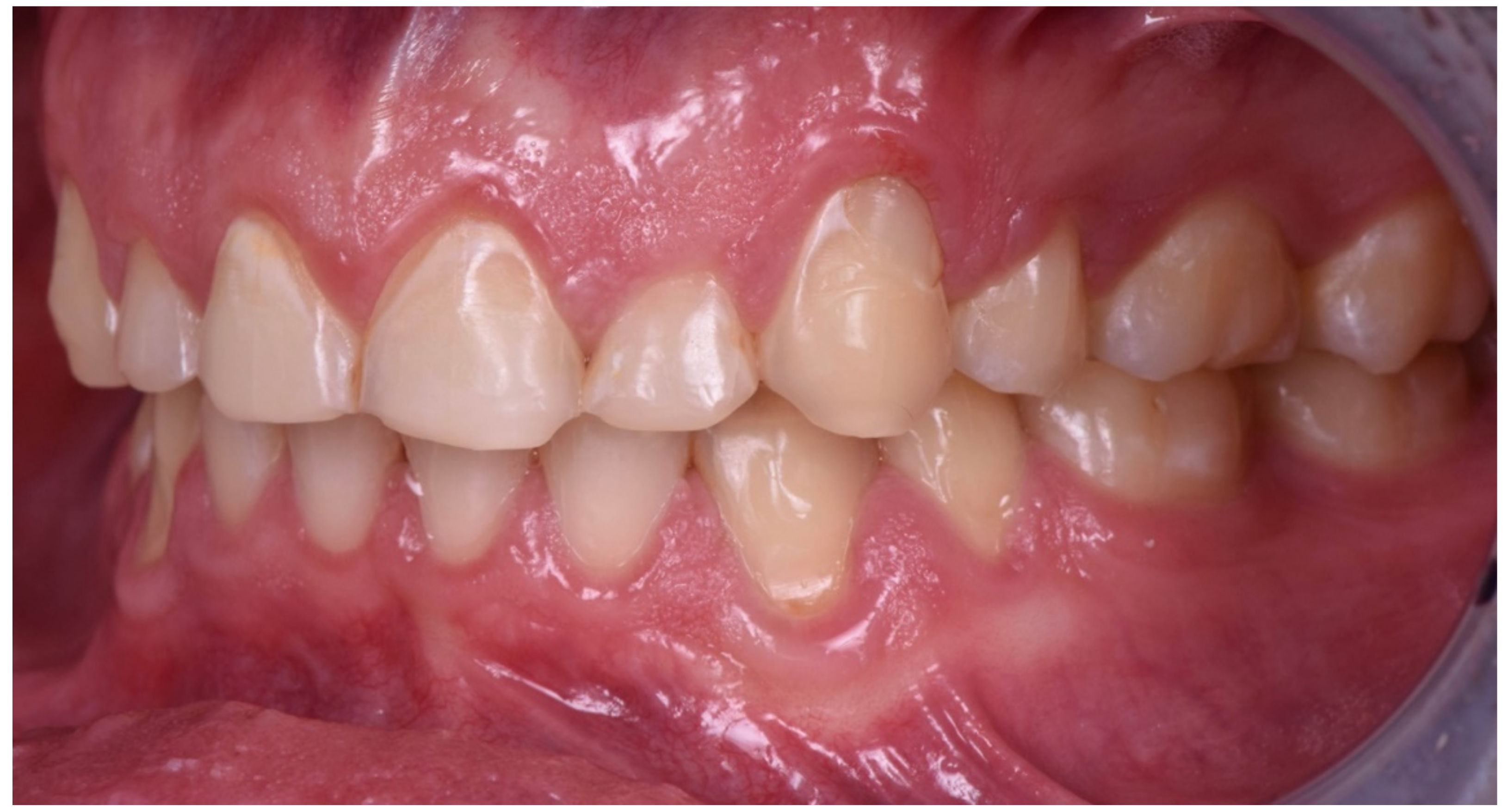 Dentistry 10 00051 g007