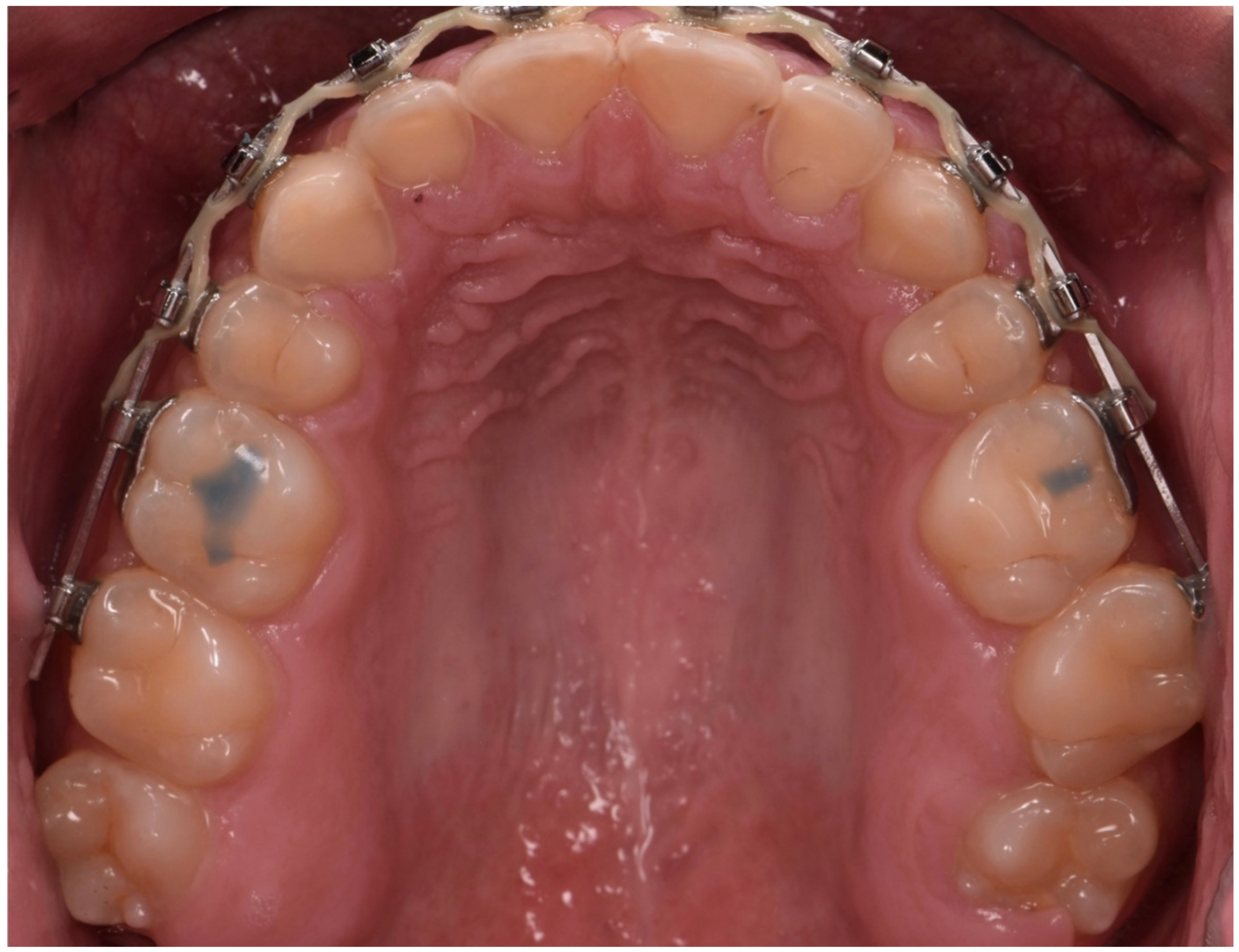 Dentistry 10 00051 g008
