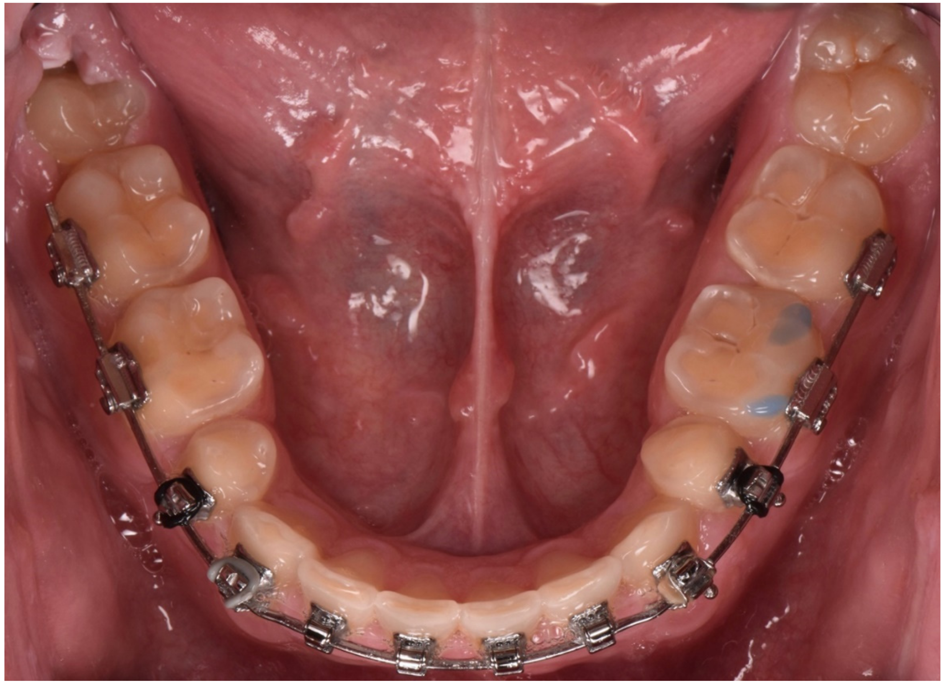 Dentistry 10 00051 g009