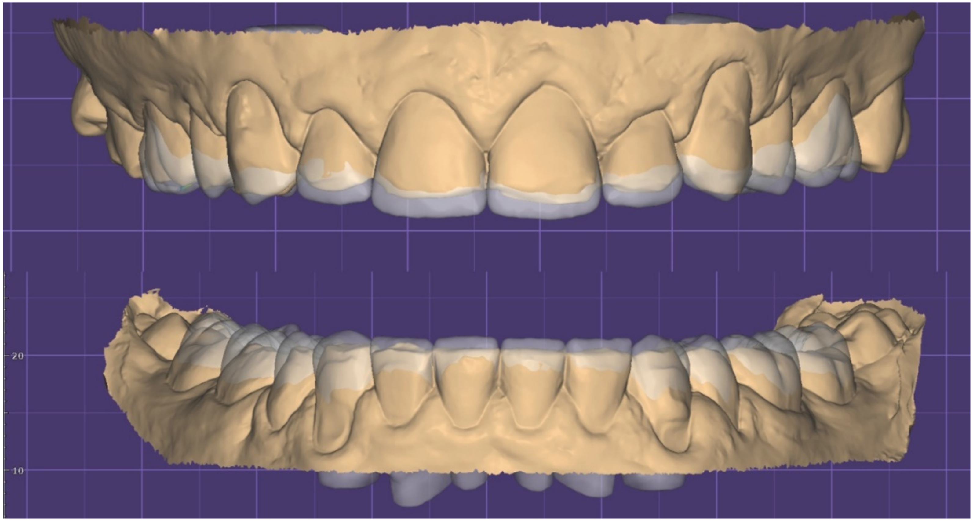 Dentistry 10 00051 g011