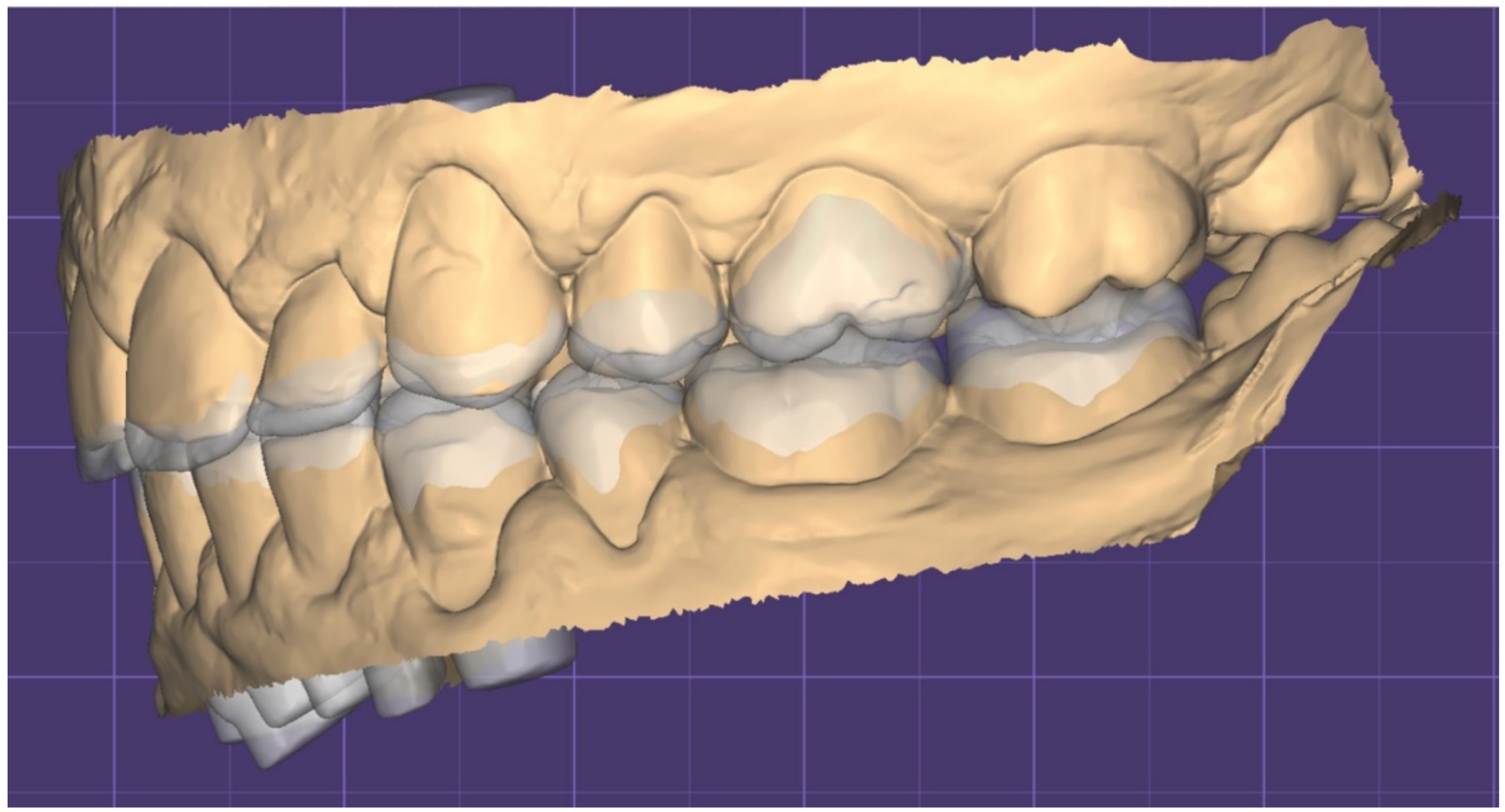 Dentistry 10 00051 g012