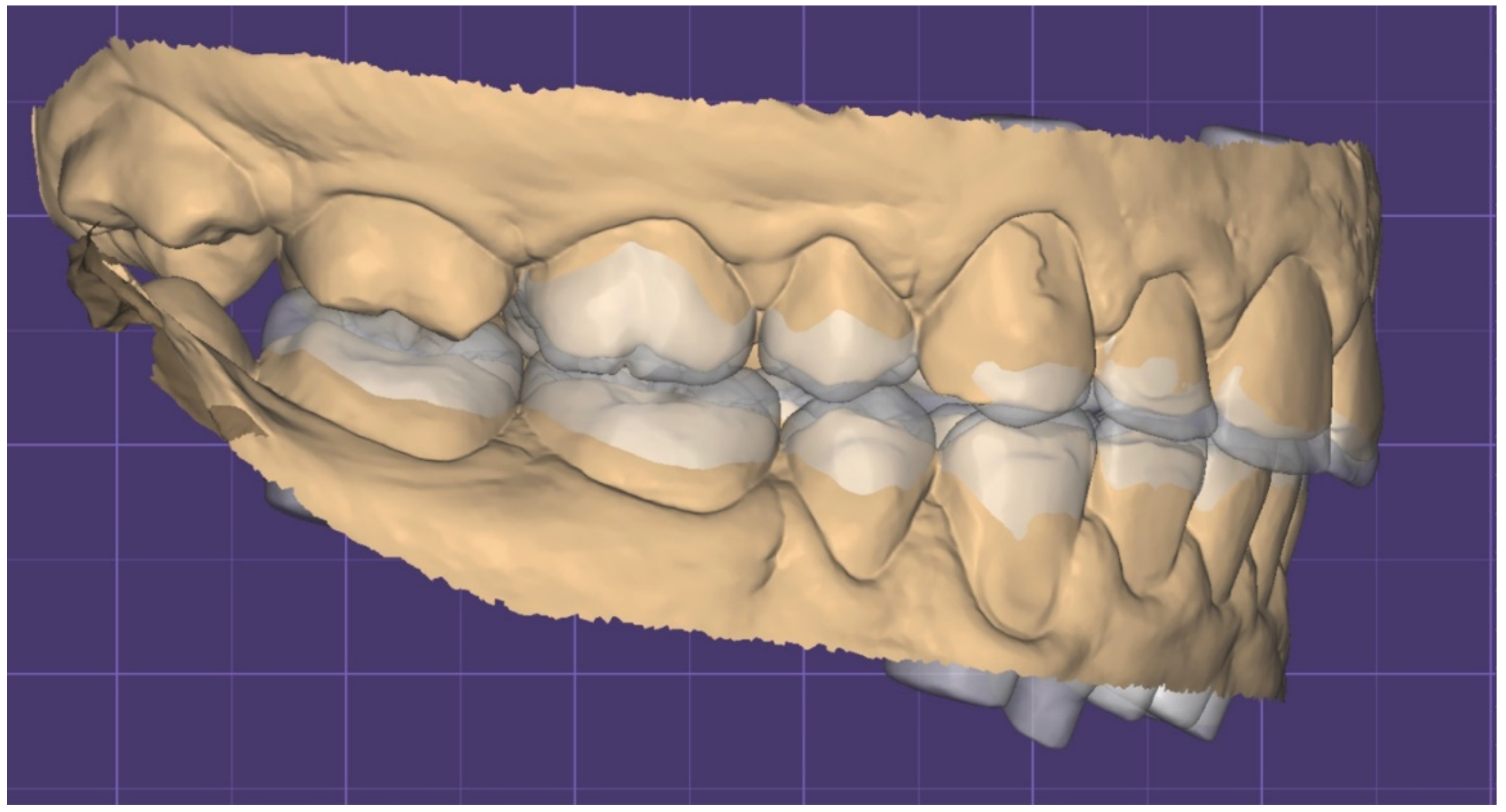 Dentistry 10 00051 g013