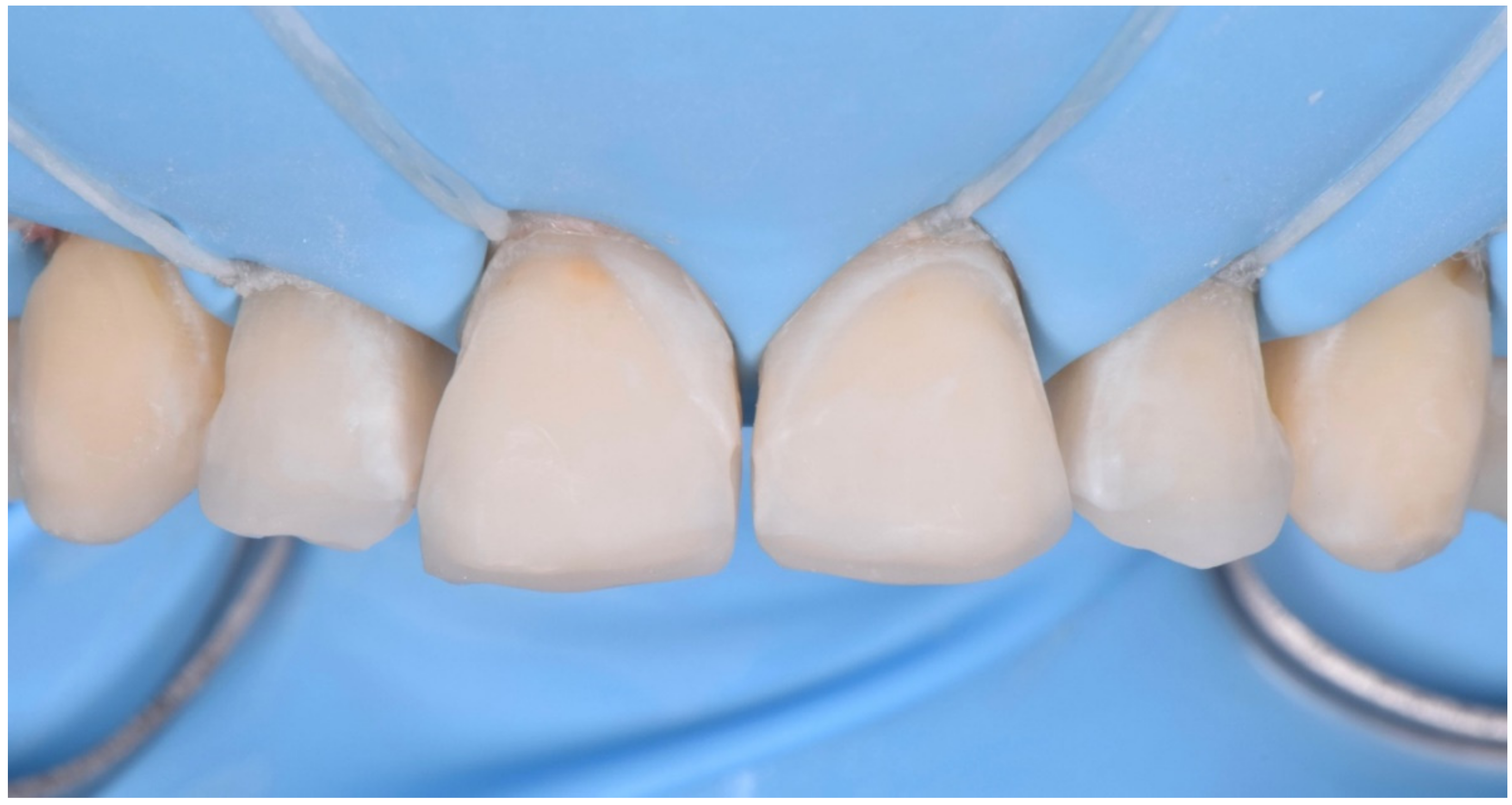 Dentistry 10 00051 g023