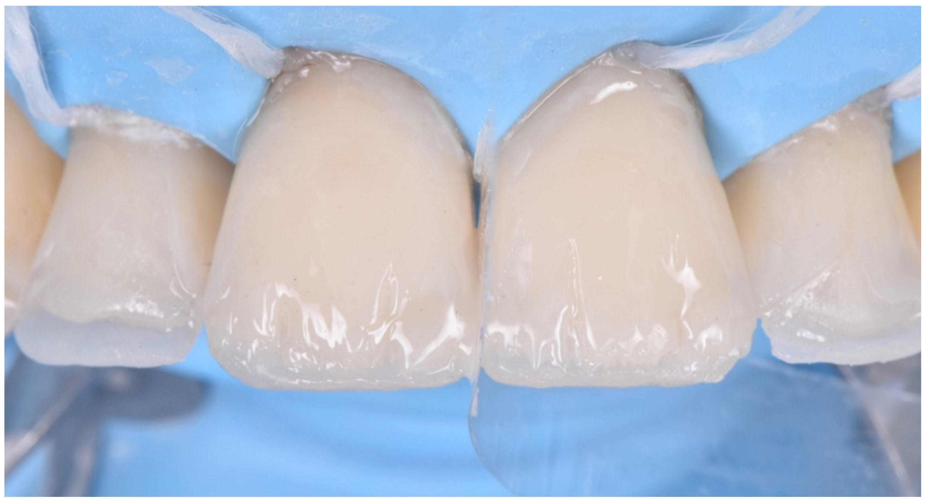 Dentistry 10 00051 g025