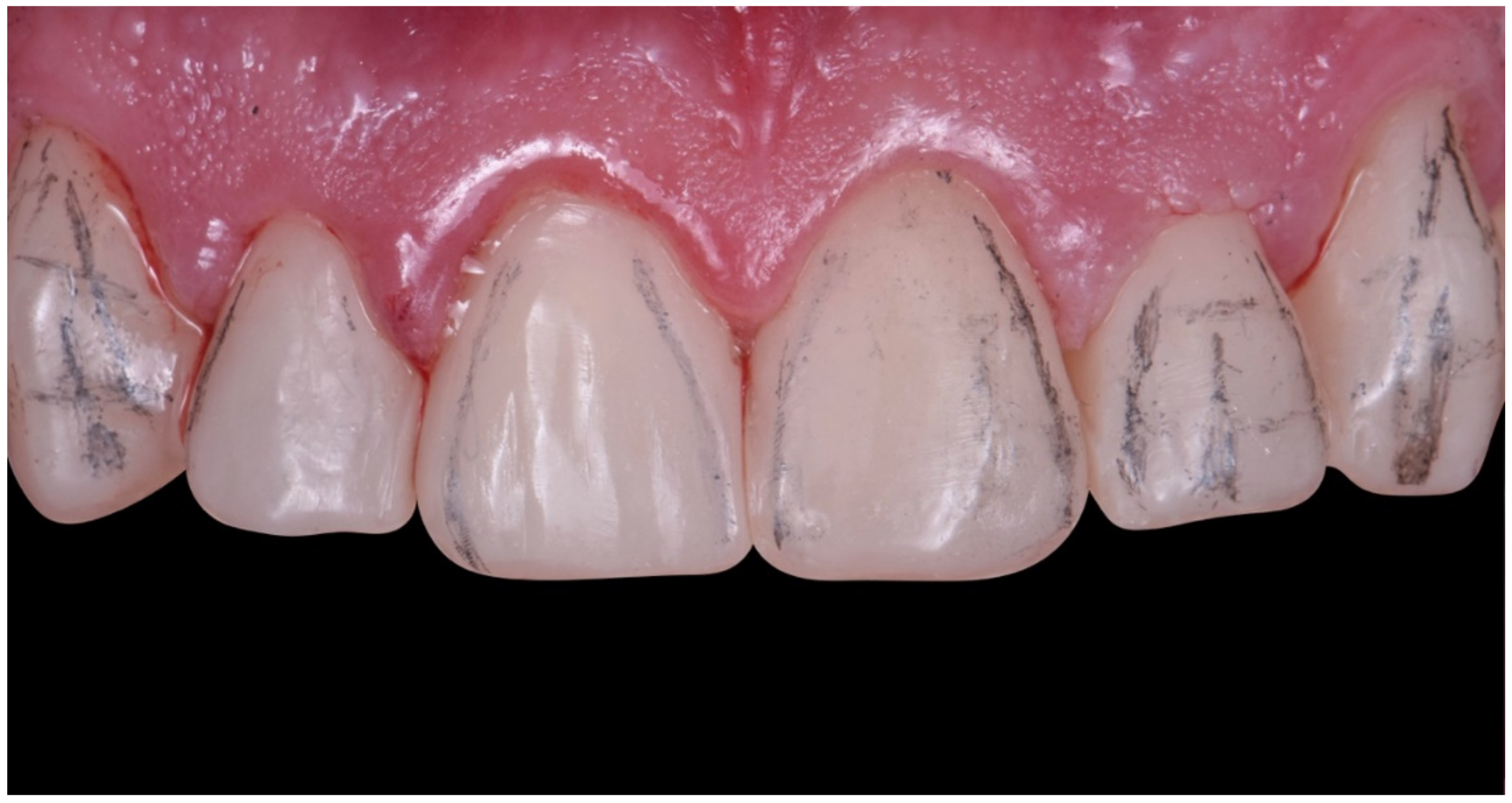 Dentistry 10 00051 g026