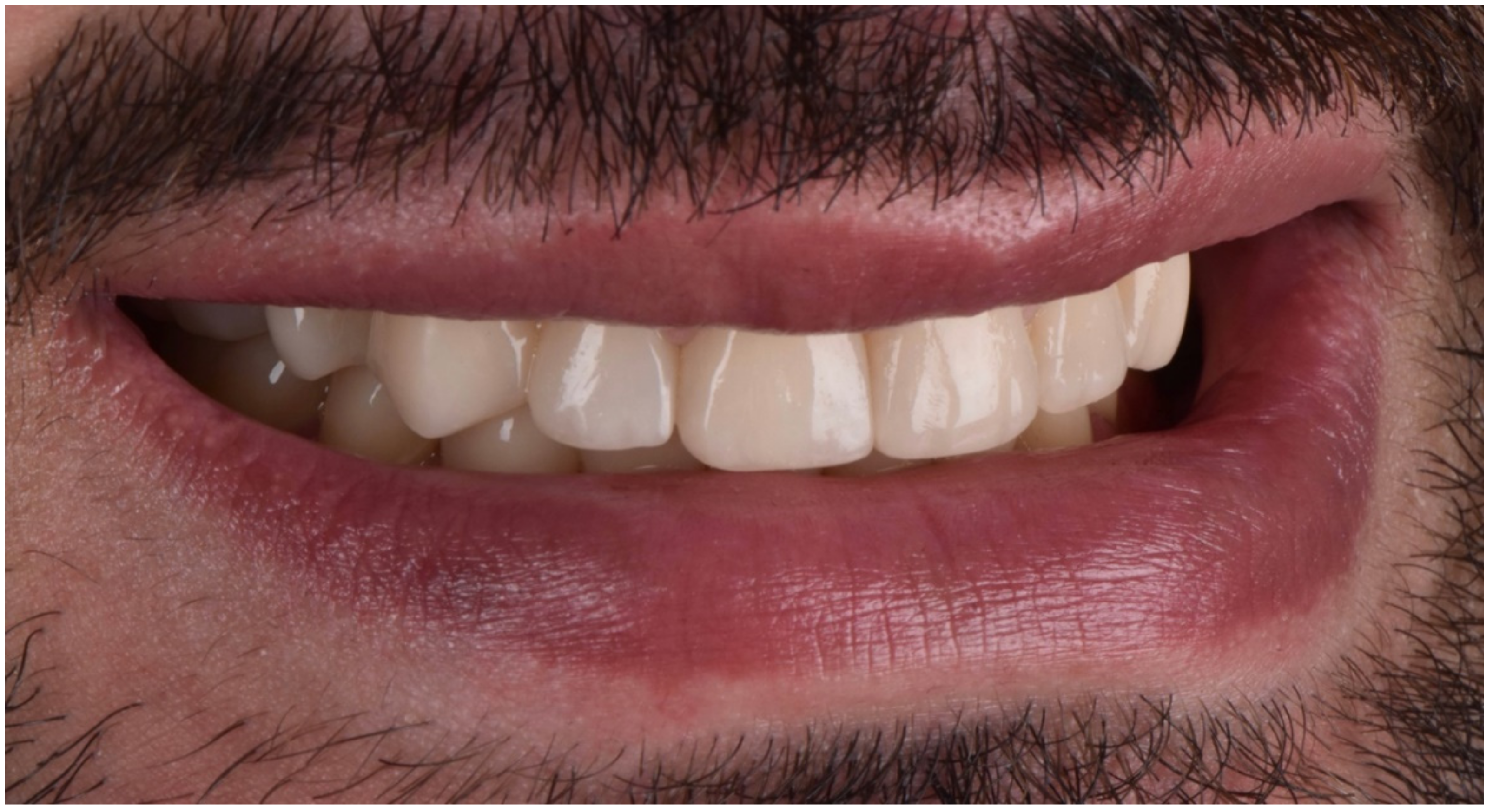 Dentistry 10 00051 g028