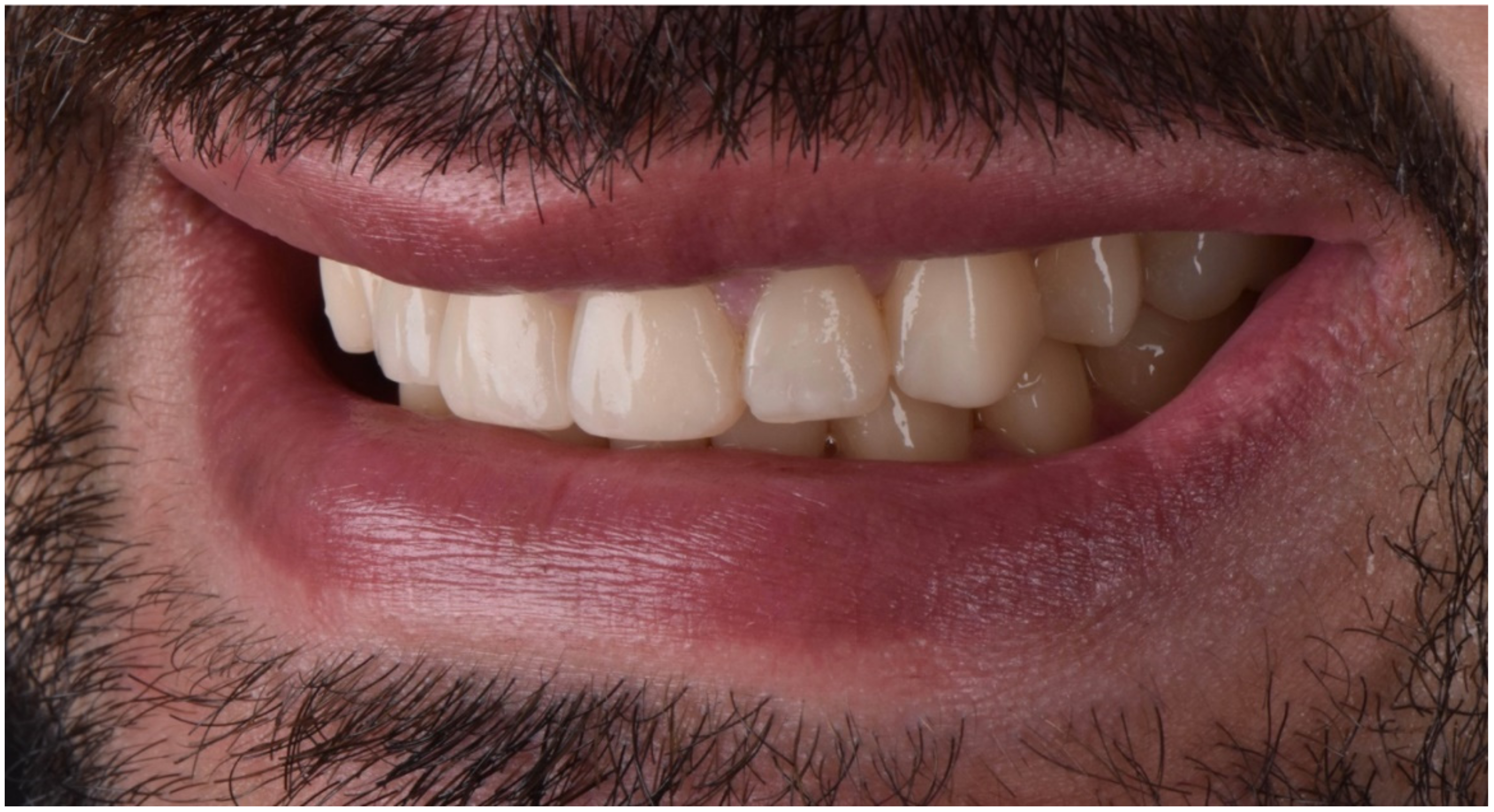 Dentistry 10 00051 g029