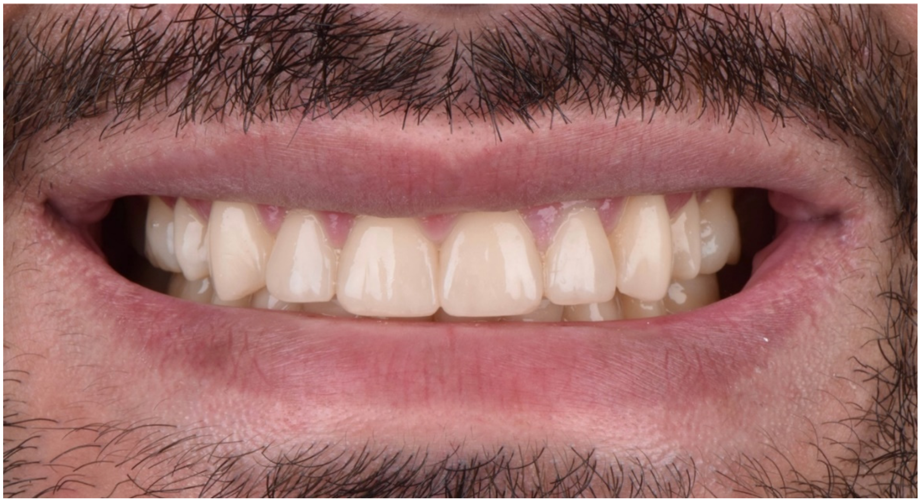 Dentistry 10 00051 g030