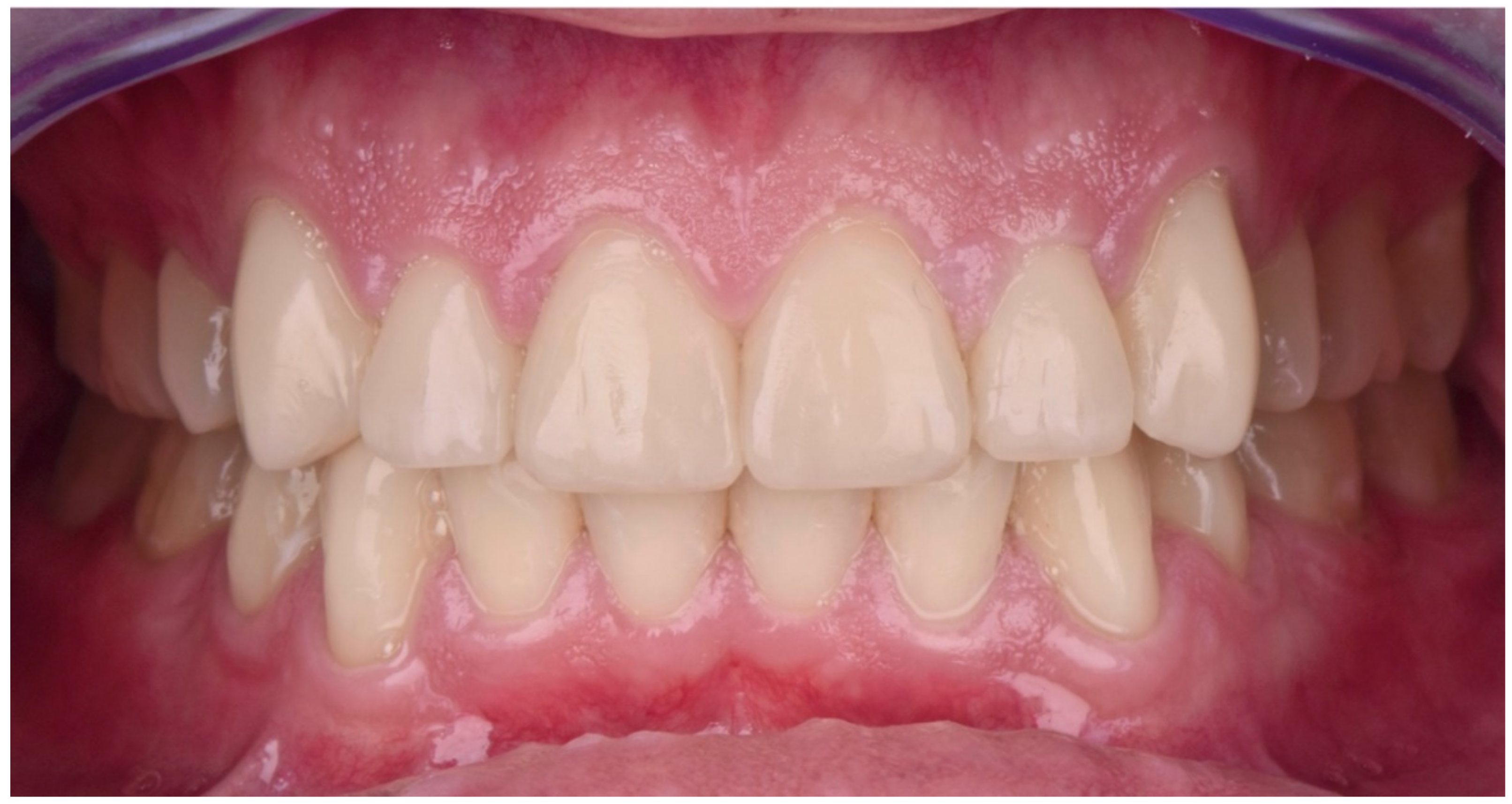 Dentistry 10 00051 g031