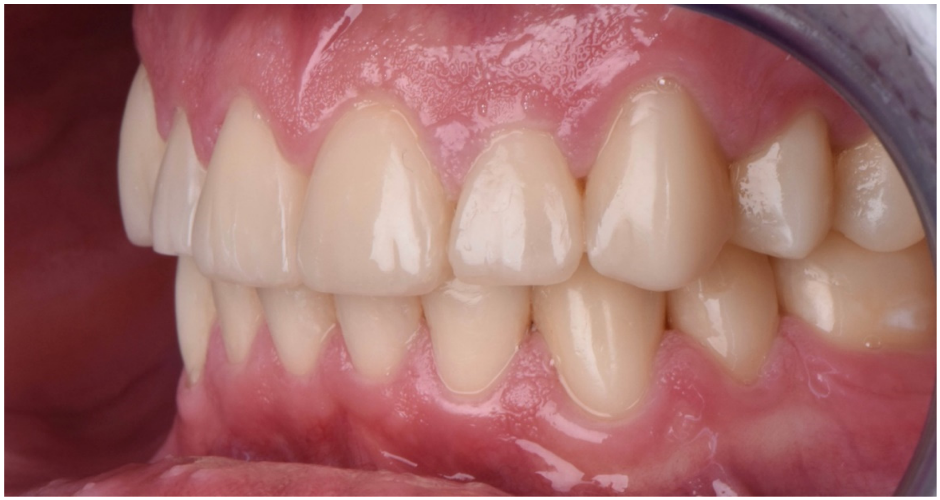 Dentistry 10 00051 g032