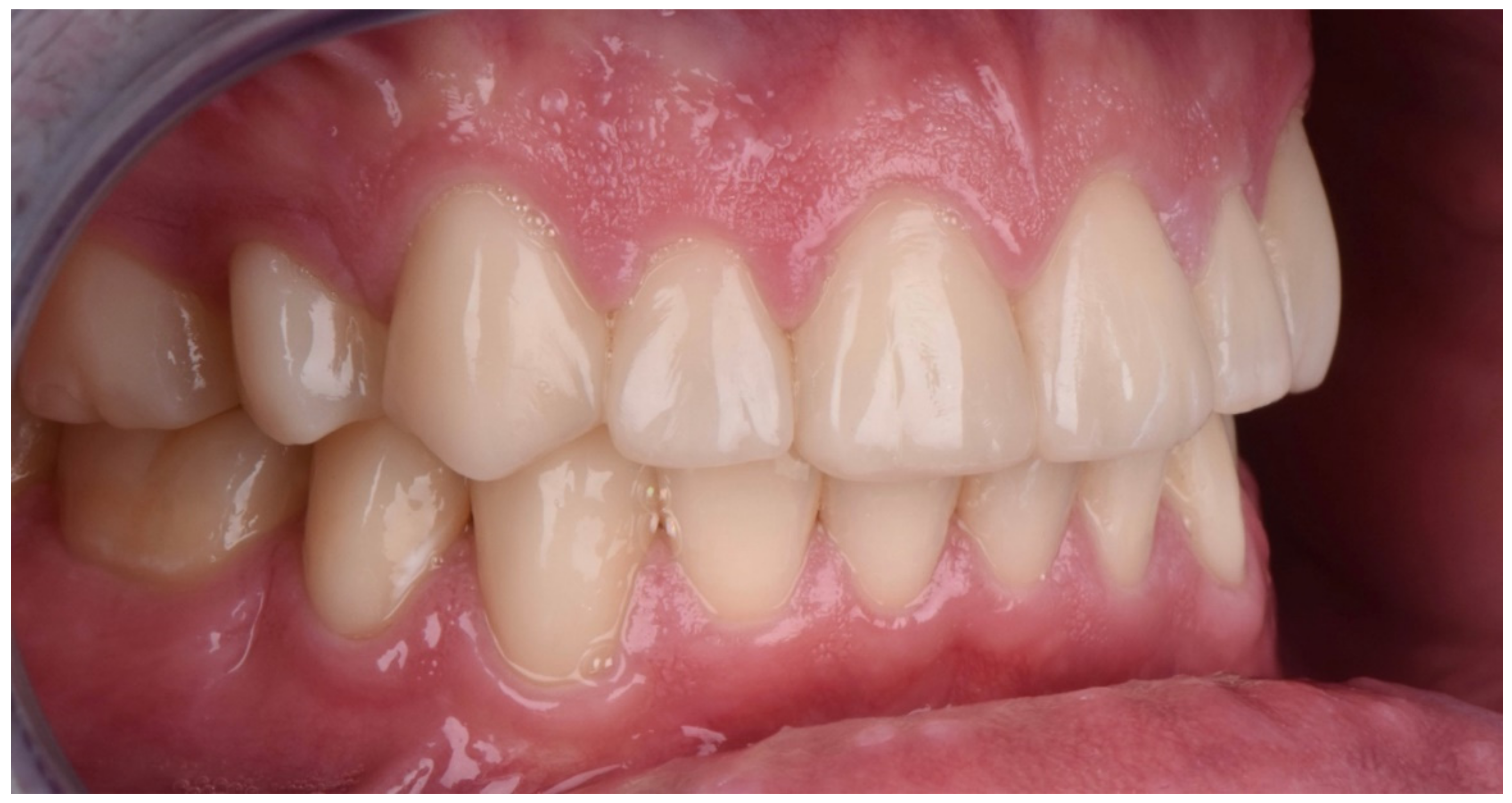 Dentistry 10 00051 g033