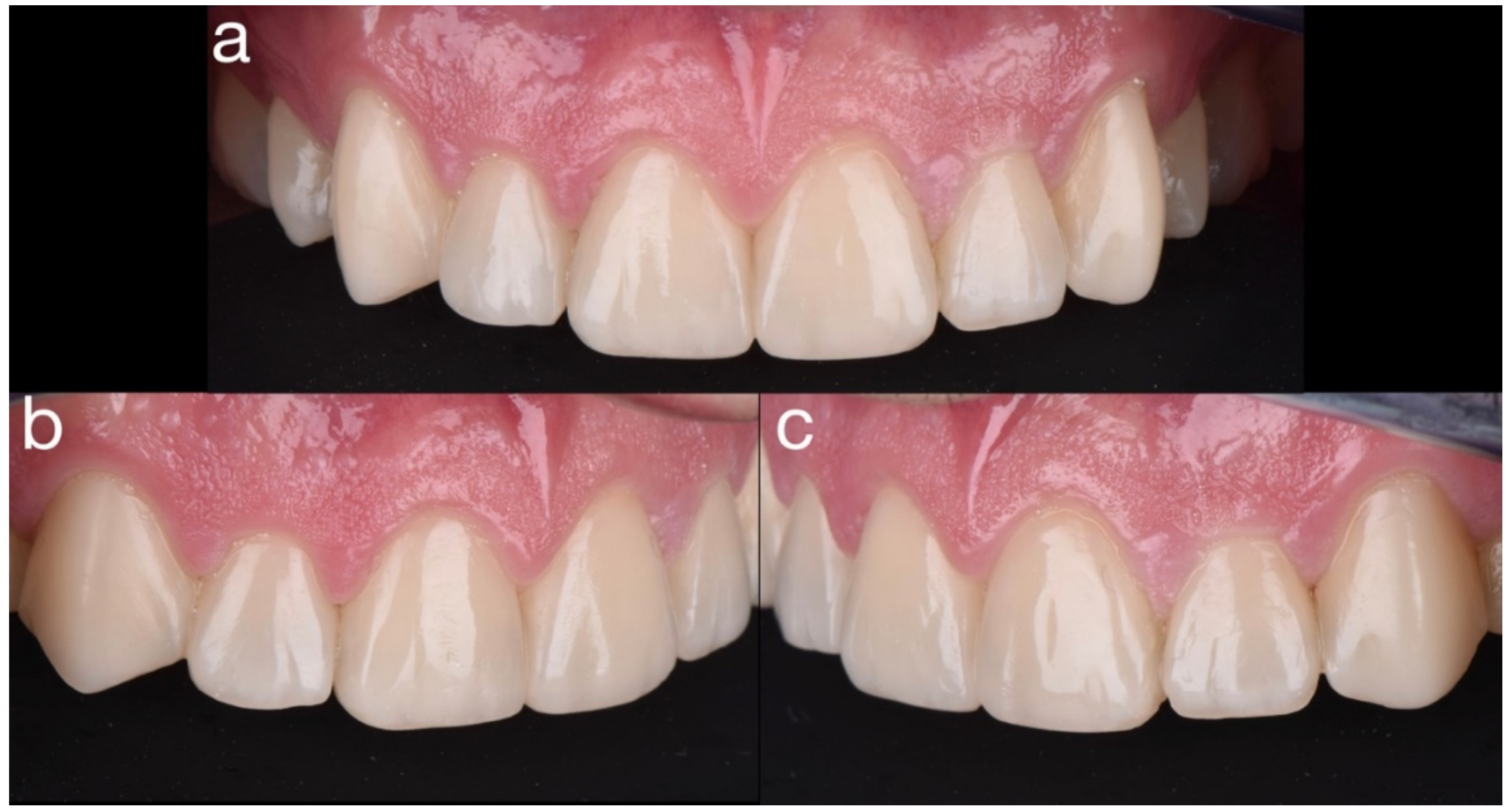 Dentistry 10 00051 g034