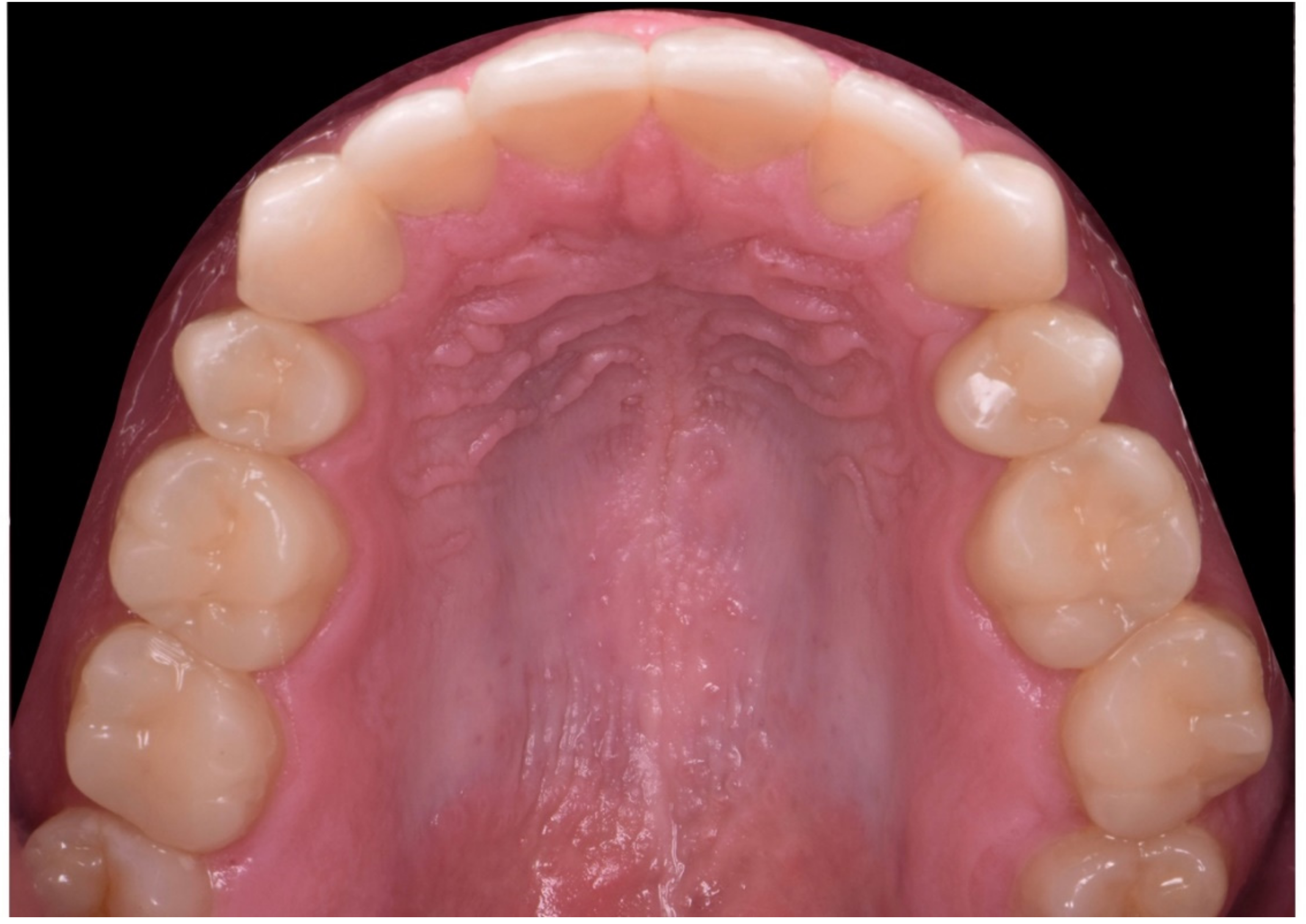 Dentistry 10 00051 g035