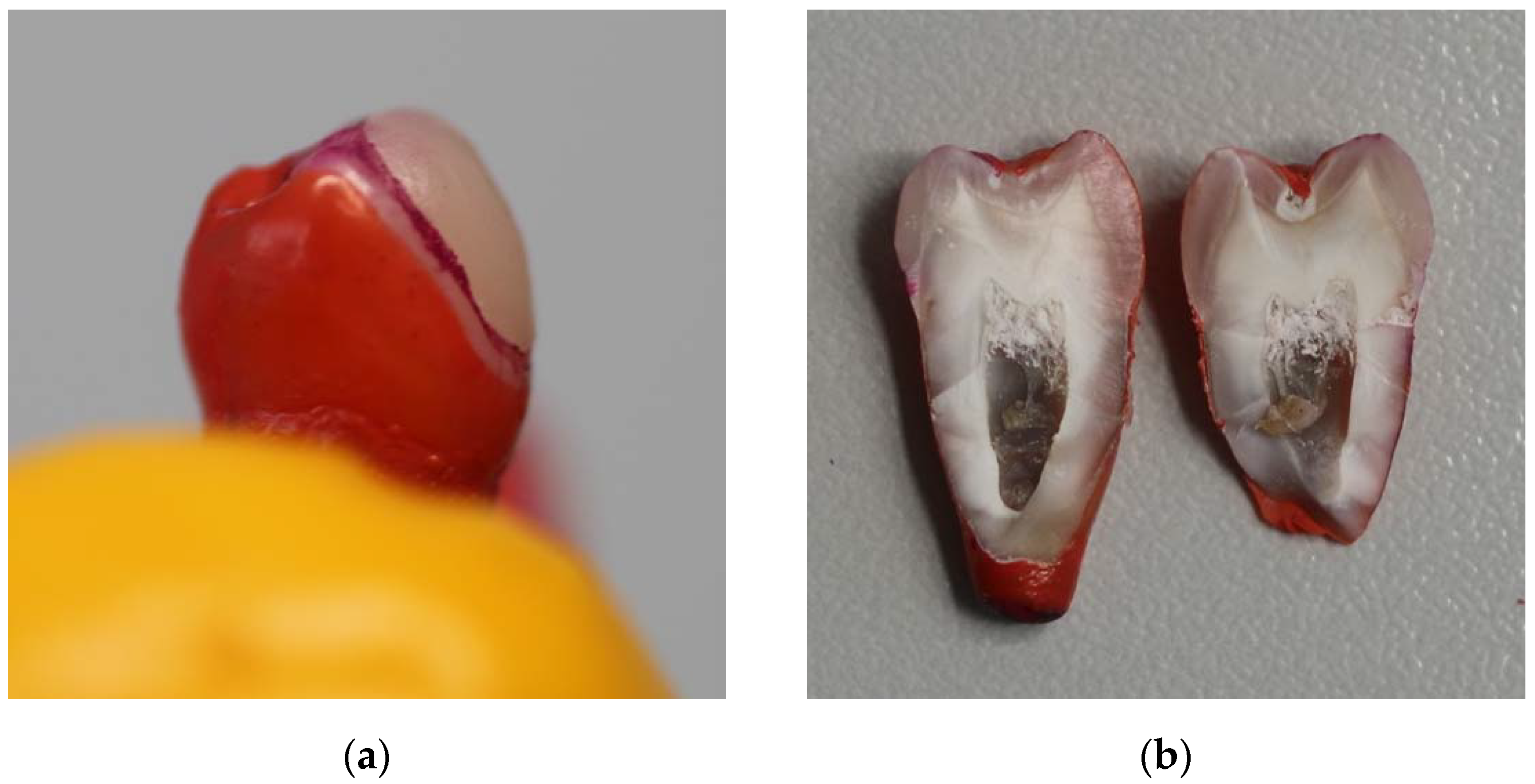 Dentistry 10 00055 g006