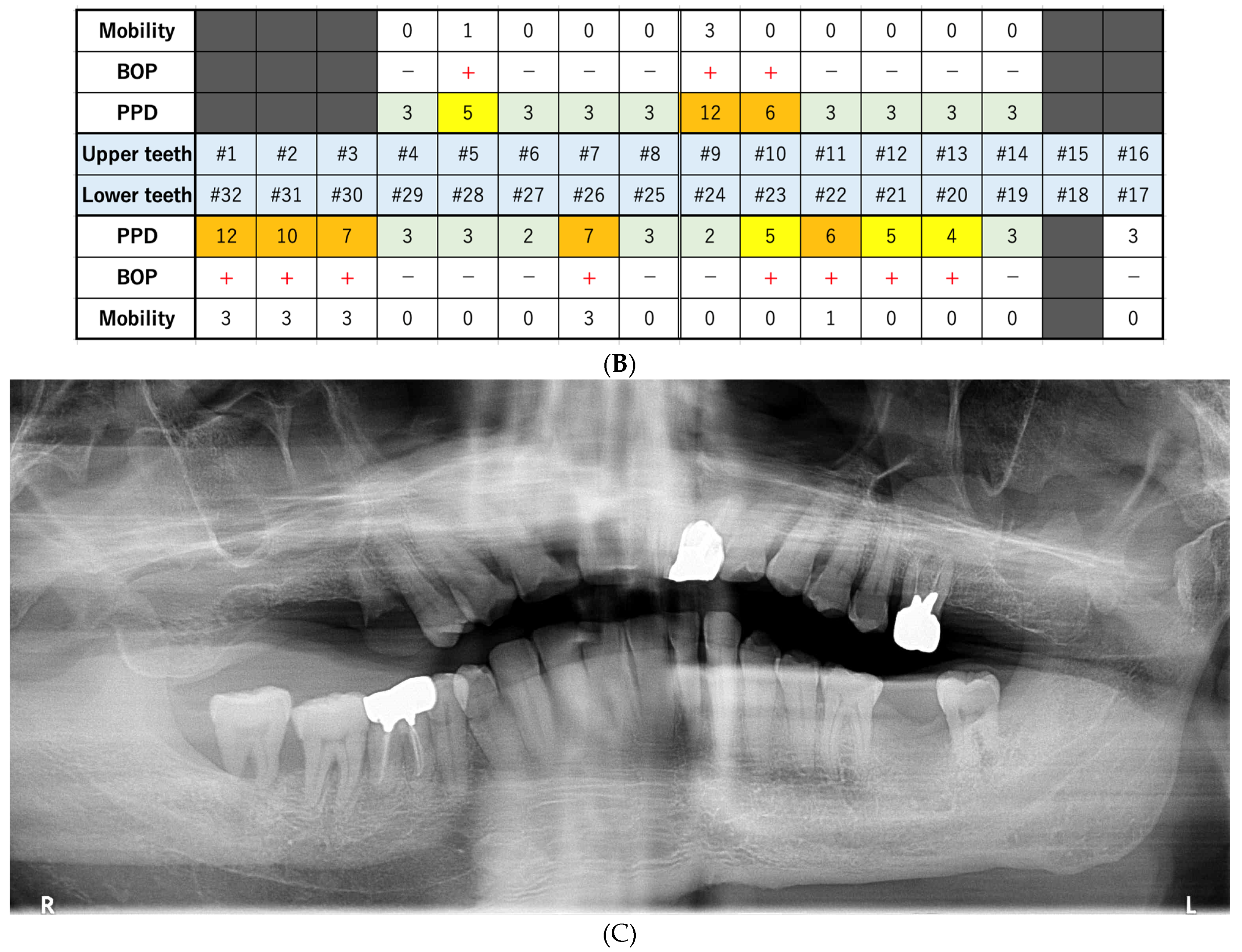 Dentistry 10 00079 g002b
