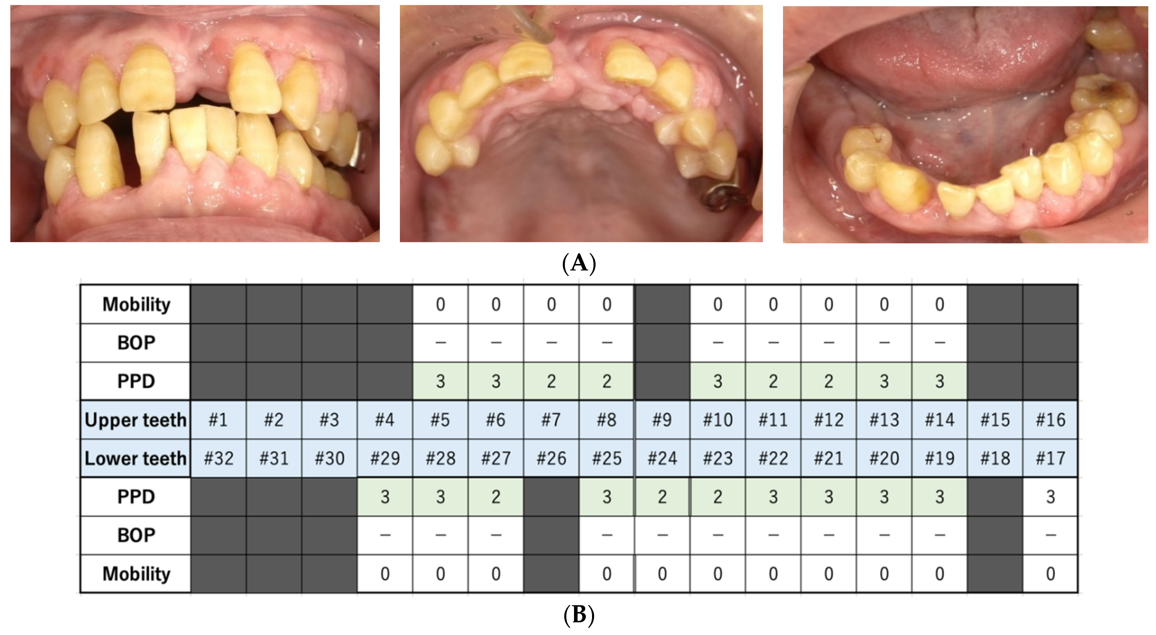 Dentistry 10 00079 g004a