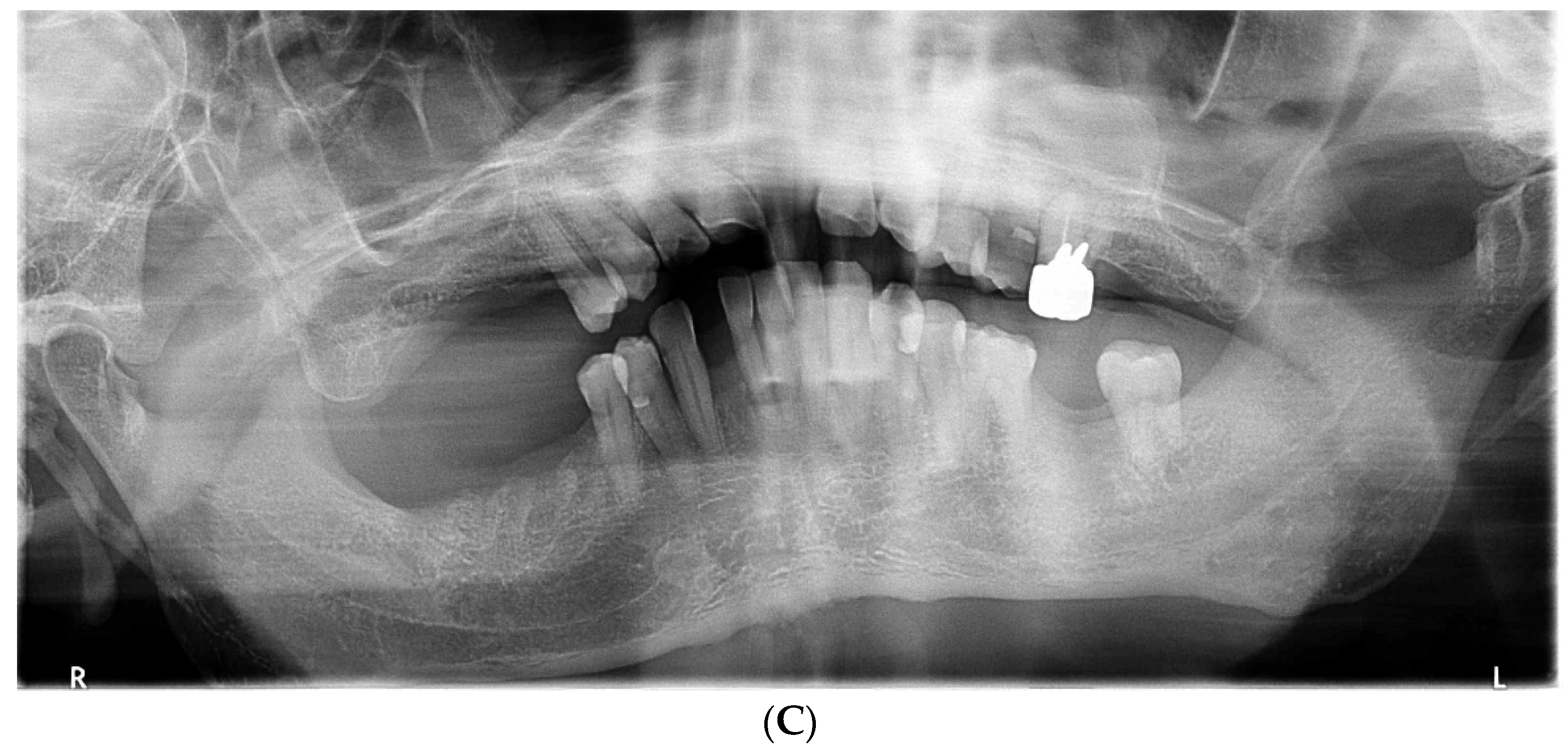 Dentistry 10 00079 g004b