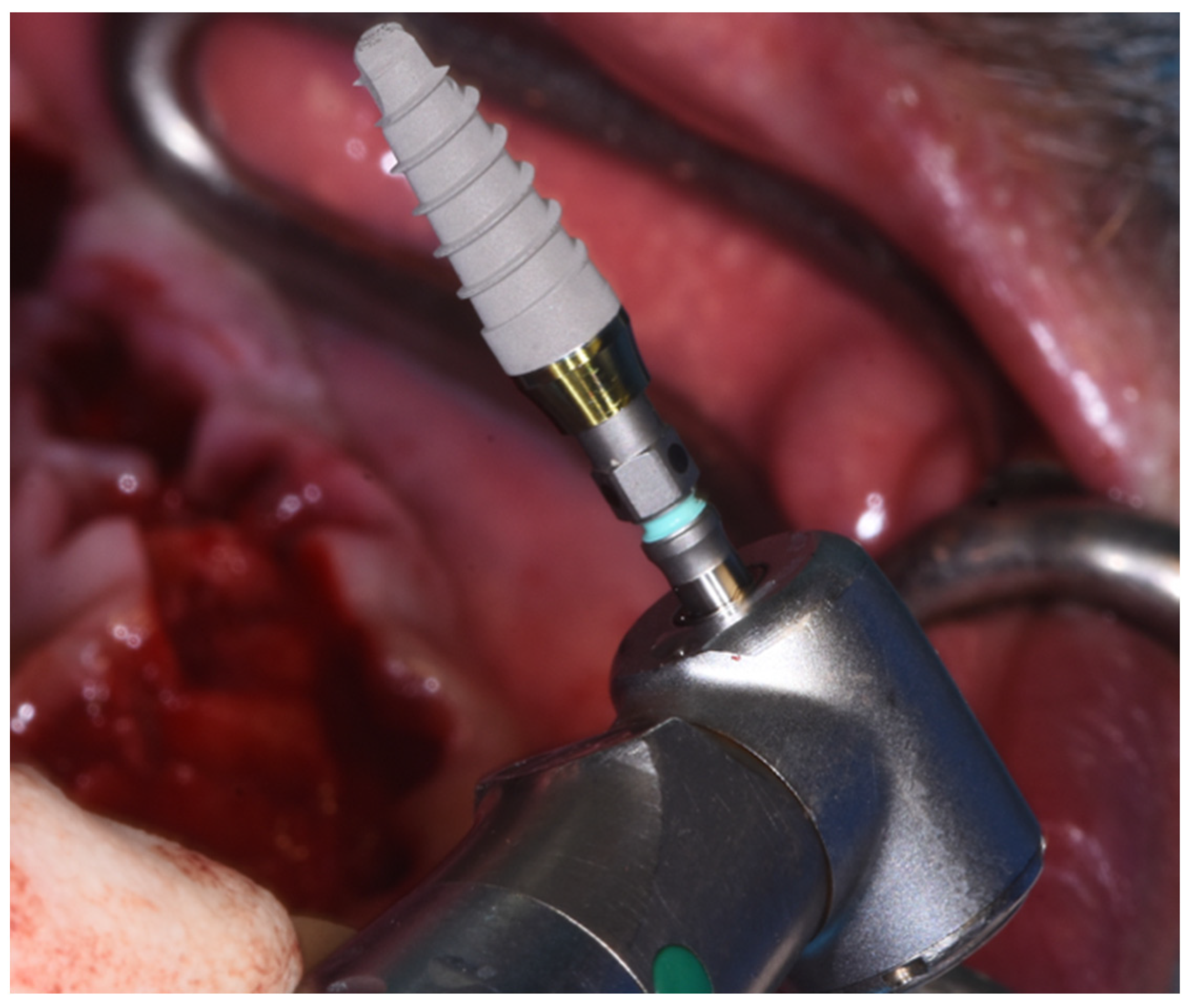 Dentistry 10 00116 g005