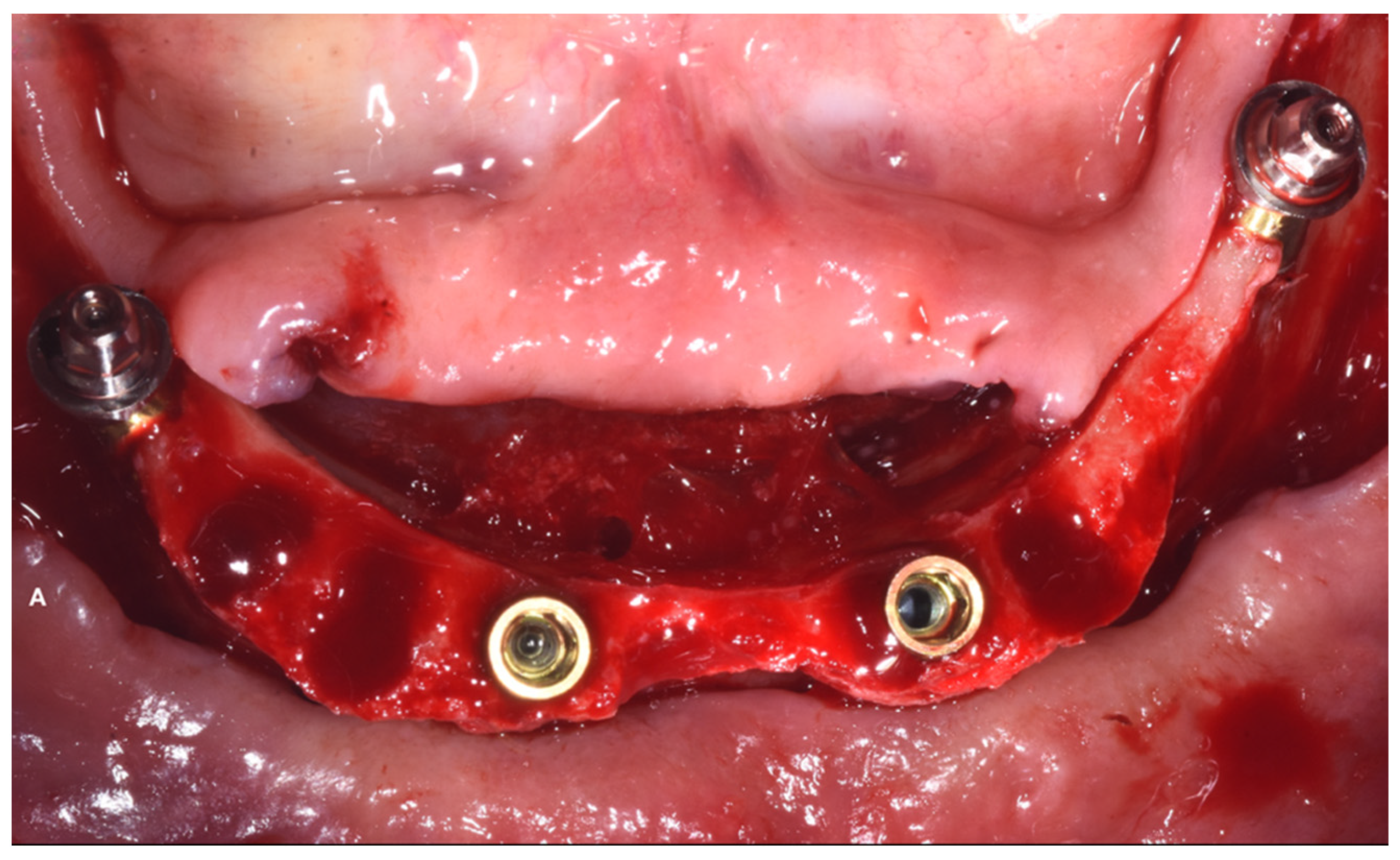 Dentistry 10 00116 g006
