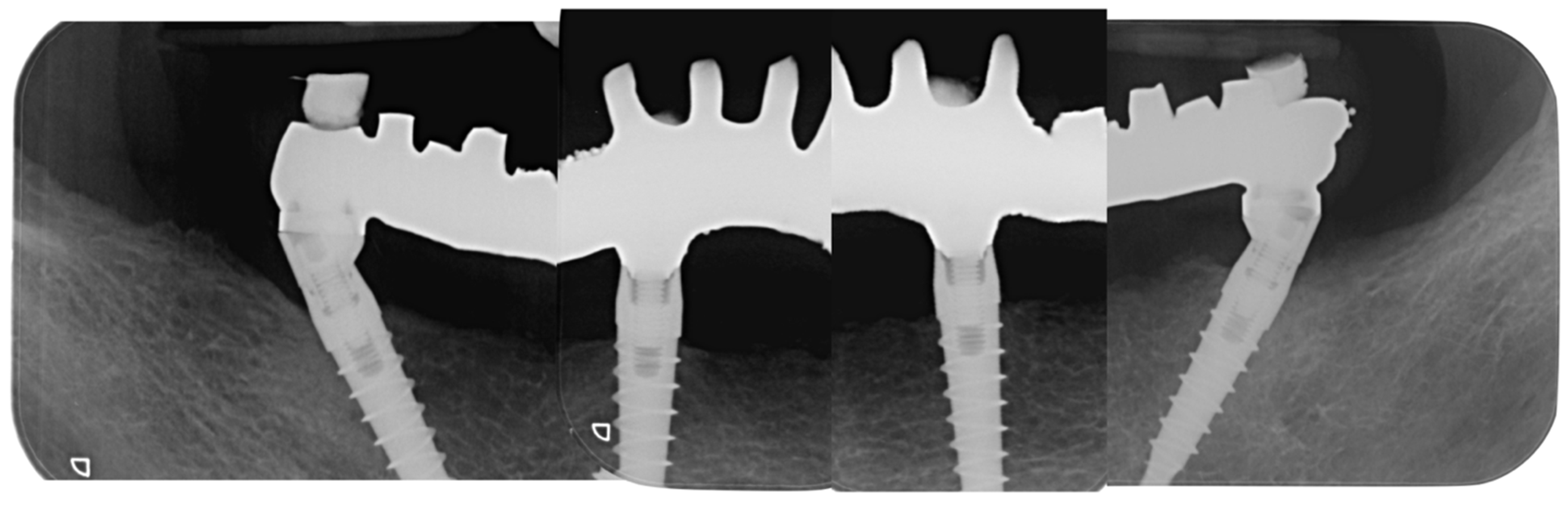 Dentistry 10 00116 g011