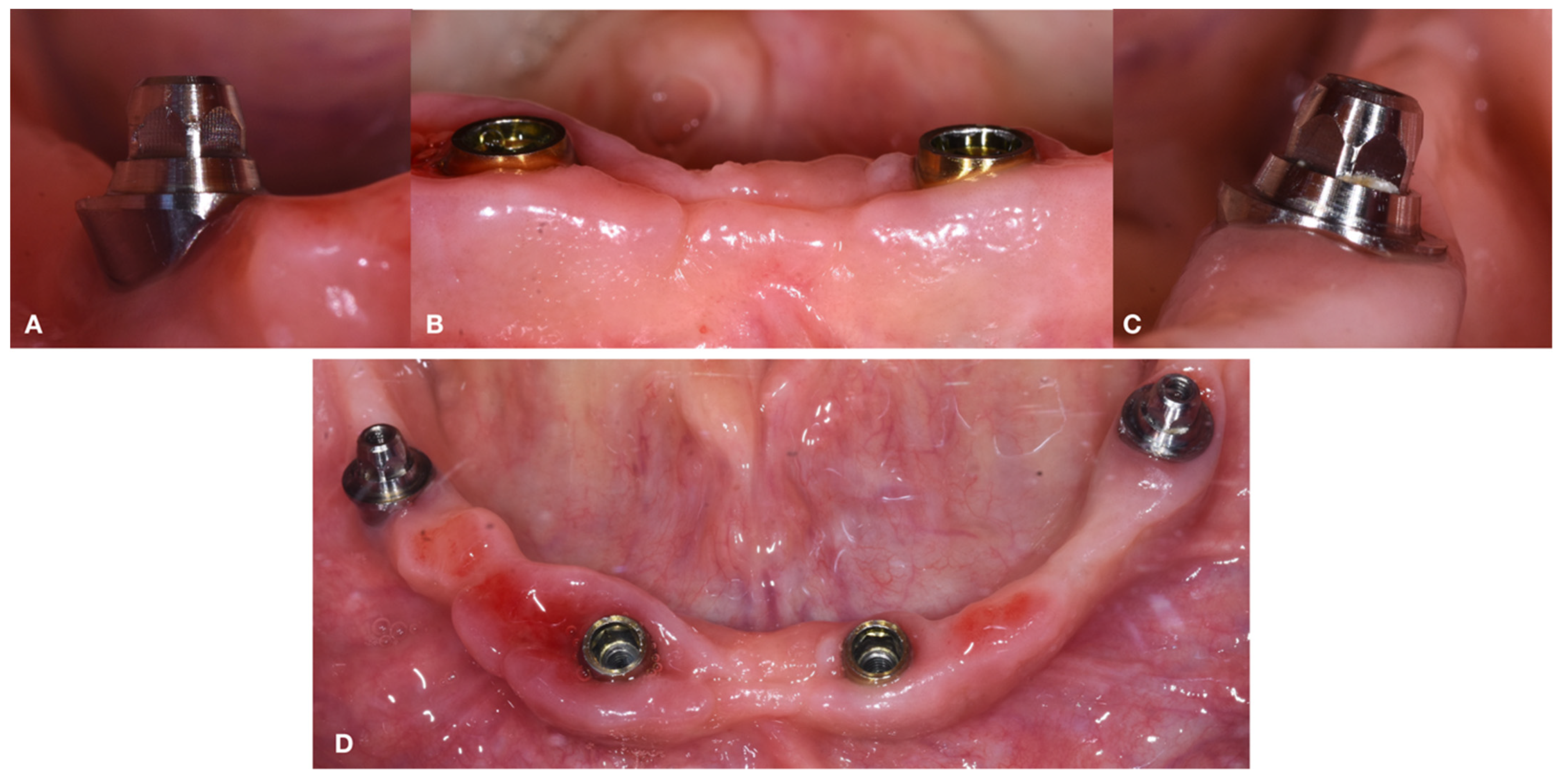 Dentistry 10 00116 g012