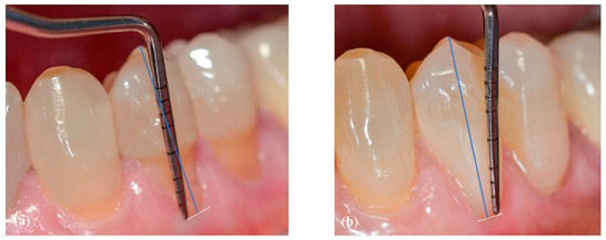 Dentistry 10 00132 g002