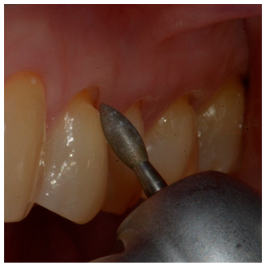 Dentistry 10 00132 g004