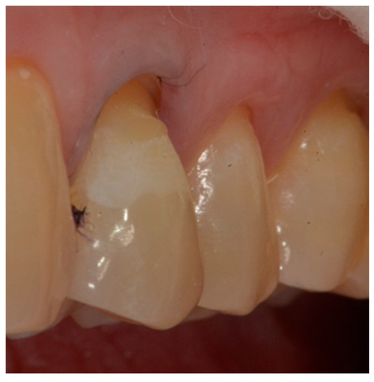 Dentistry 10 00132 g005