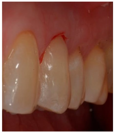 Dentistry 10 00132 g007