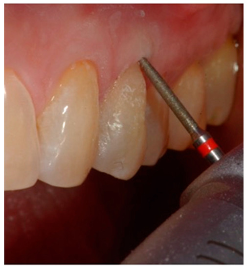 Dentistry 10 00132 g008