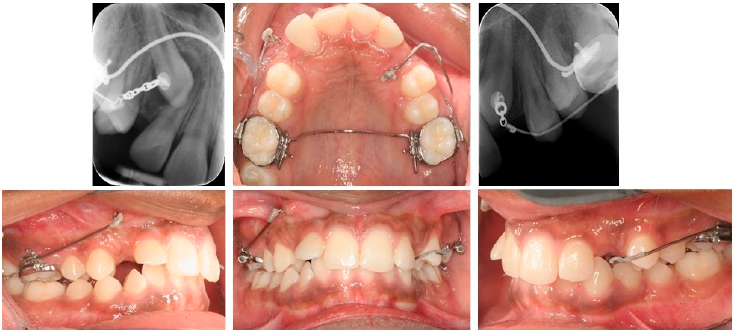 Dentistry 10 00135 g004 Dentistry 10 00135 g004