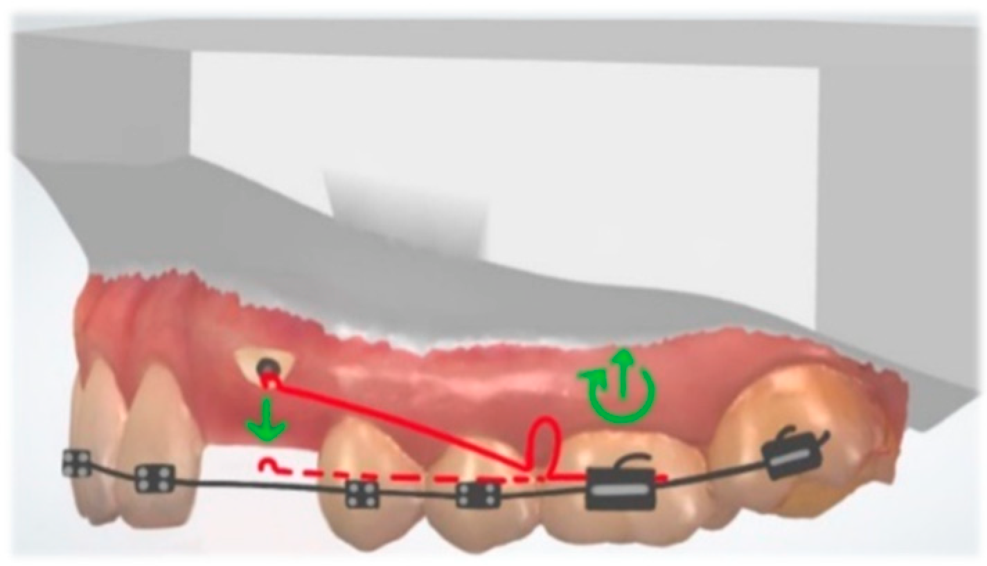 Dentistry 10 00135 g005 Dentistry 10 00135 g005
