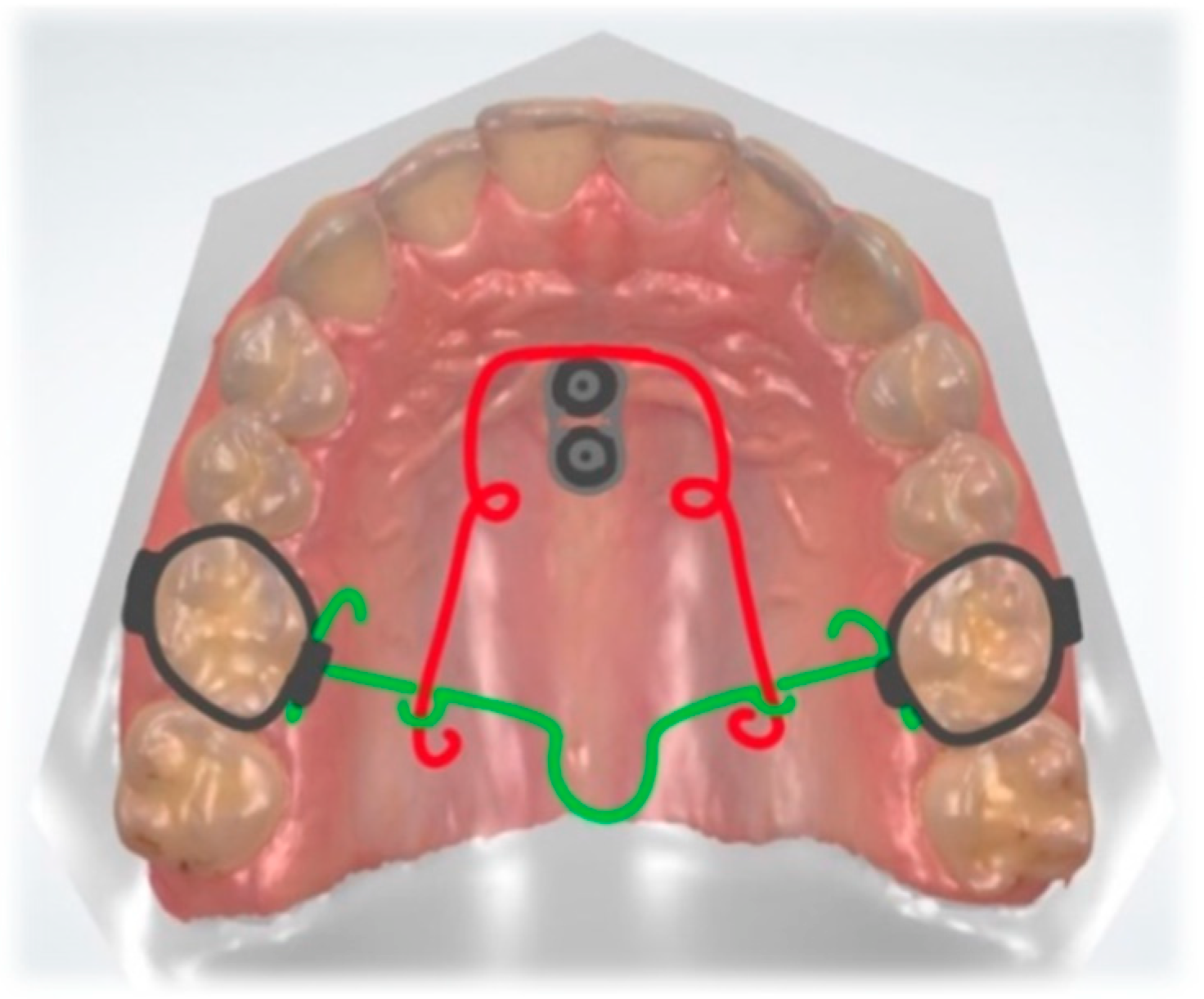 Dentistry 10 00135 g009 Dentistry 10 00135 g009