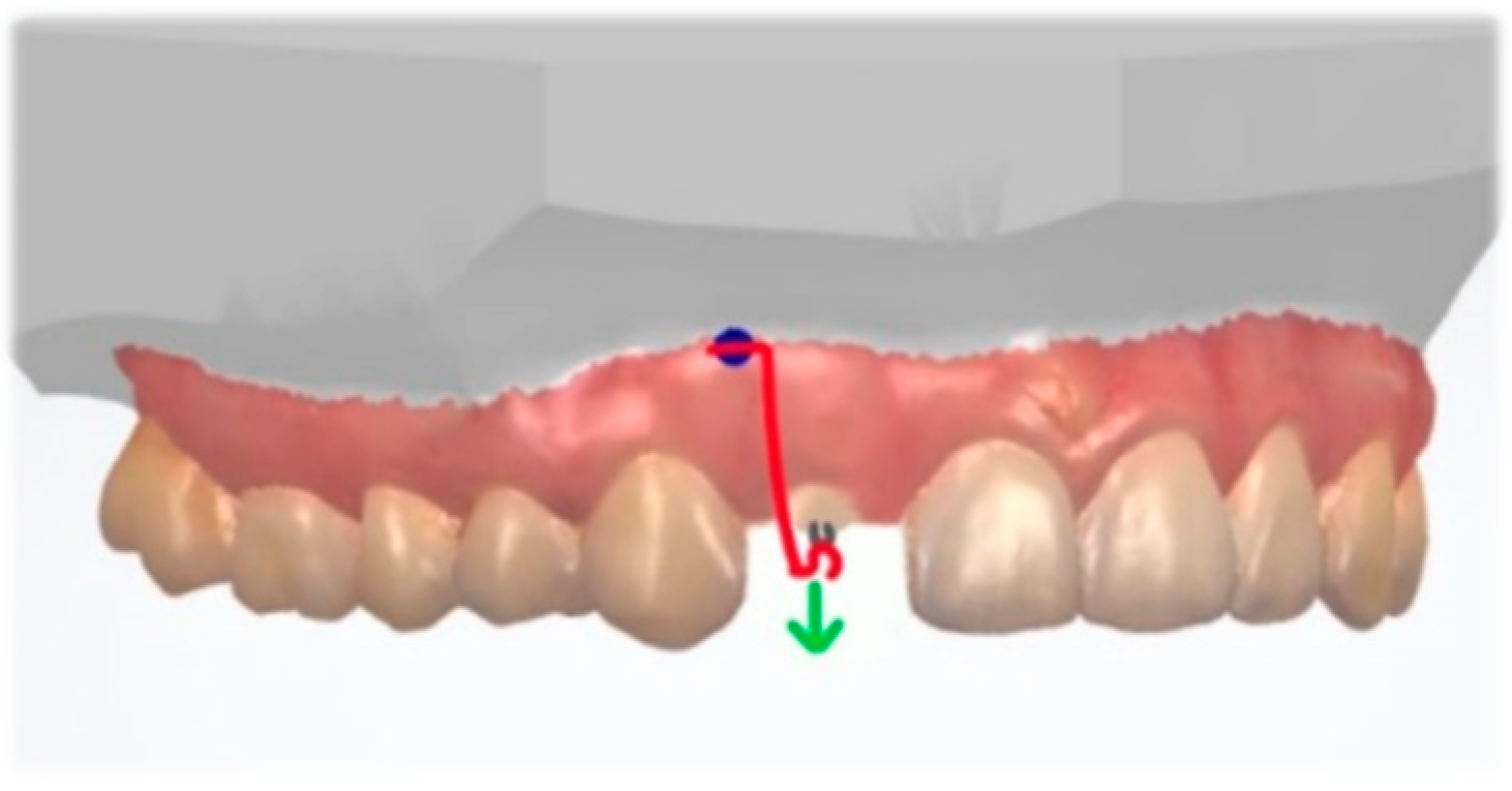 Dentistry 10 00135 g014 Dentistry 10 00135 g014