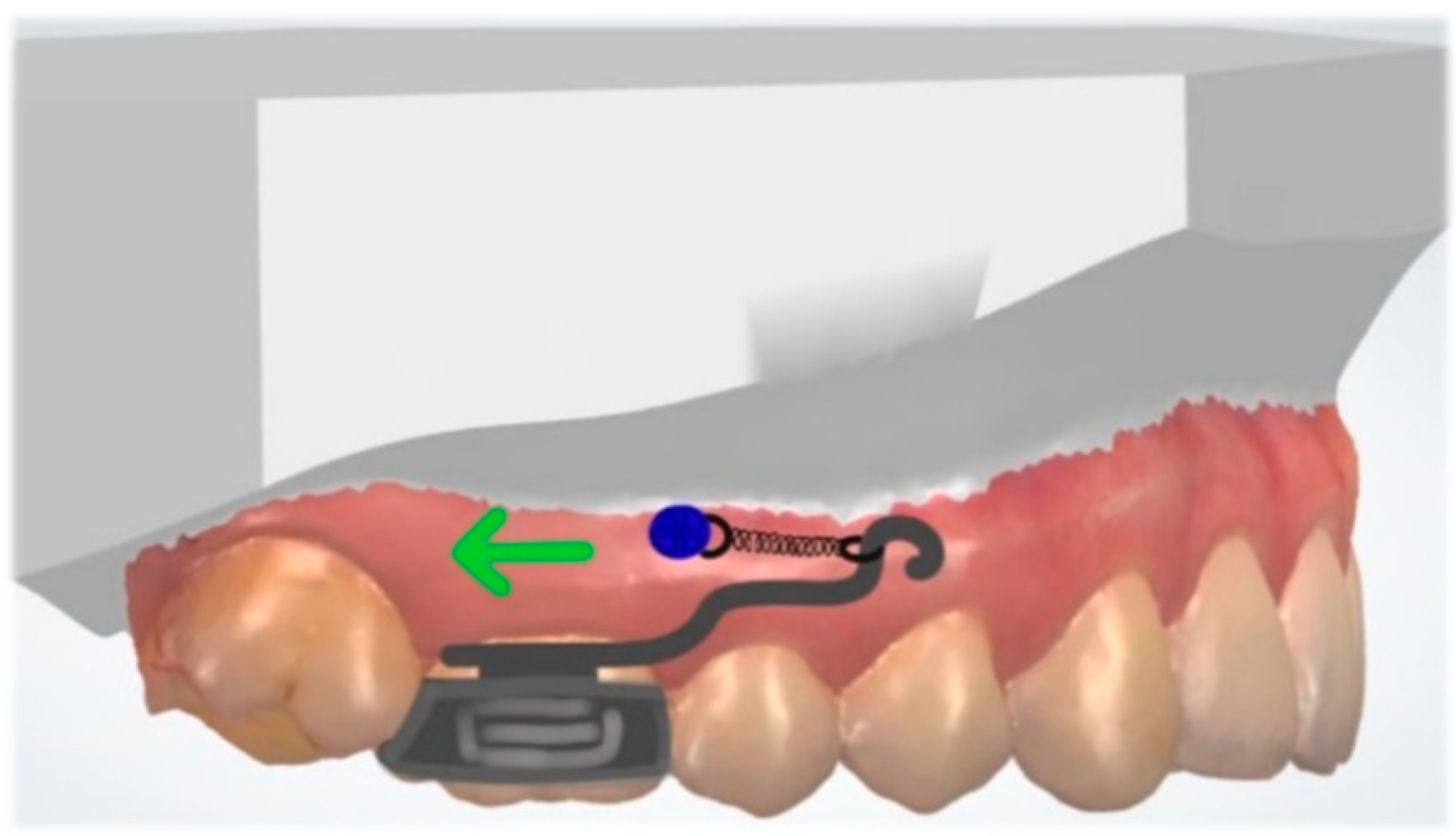 Dentistry 10 00135 g015 Dentistry 10 00135 g015