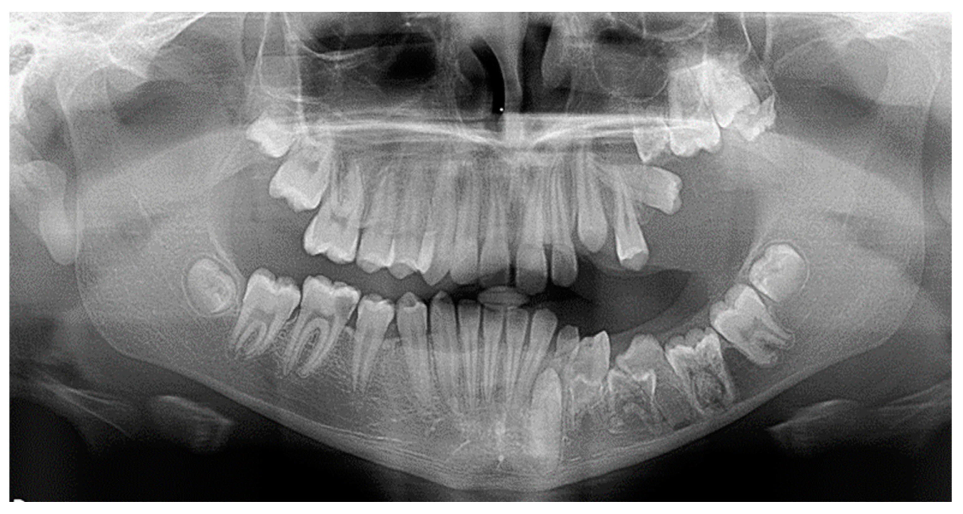 Dentistry 10 00150 g001 Dentistry 10 00150 g001