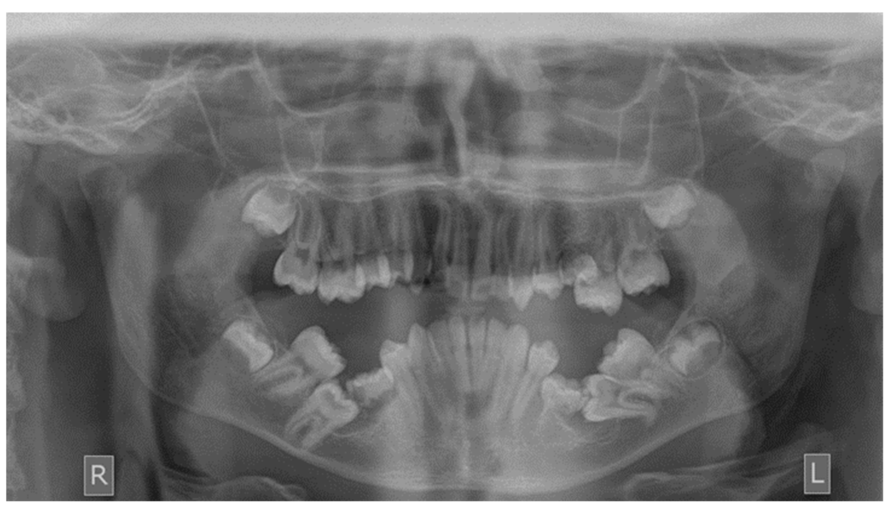 Dentistry 10 00150 g002 Dentistry 10 00150 g002