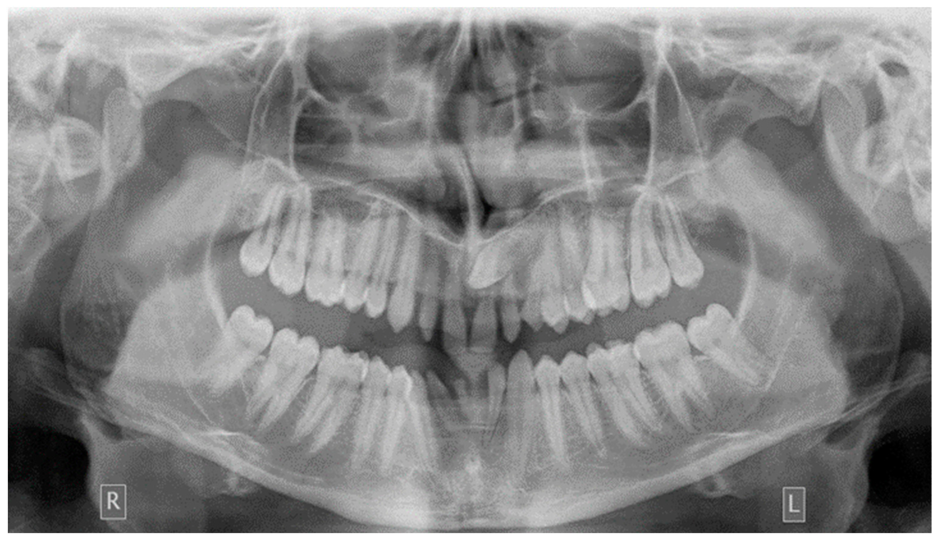 Dentistry 10 00150 g003 Dentistry 10 00150 g003