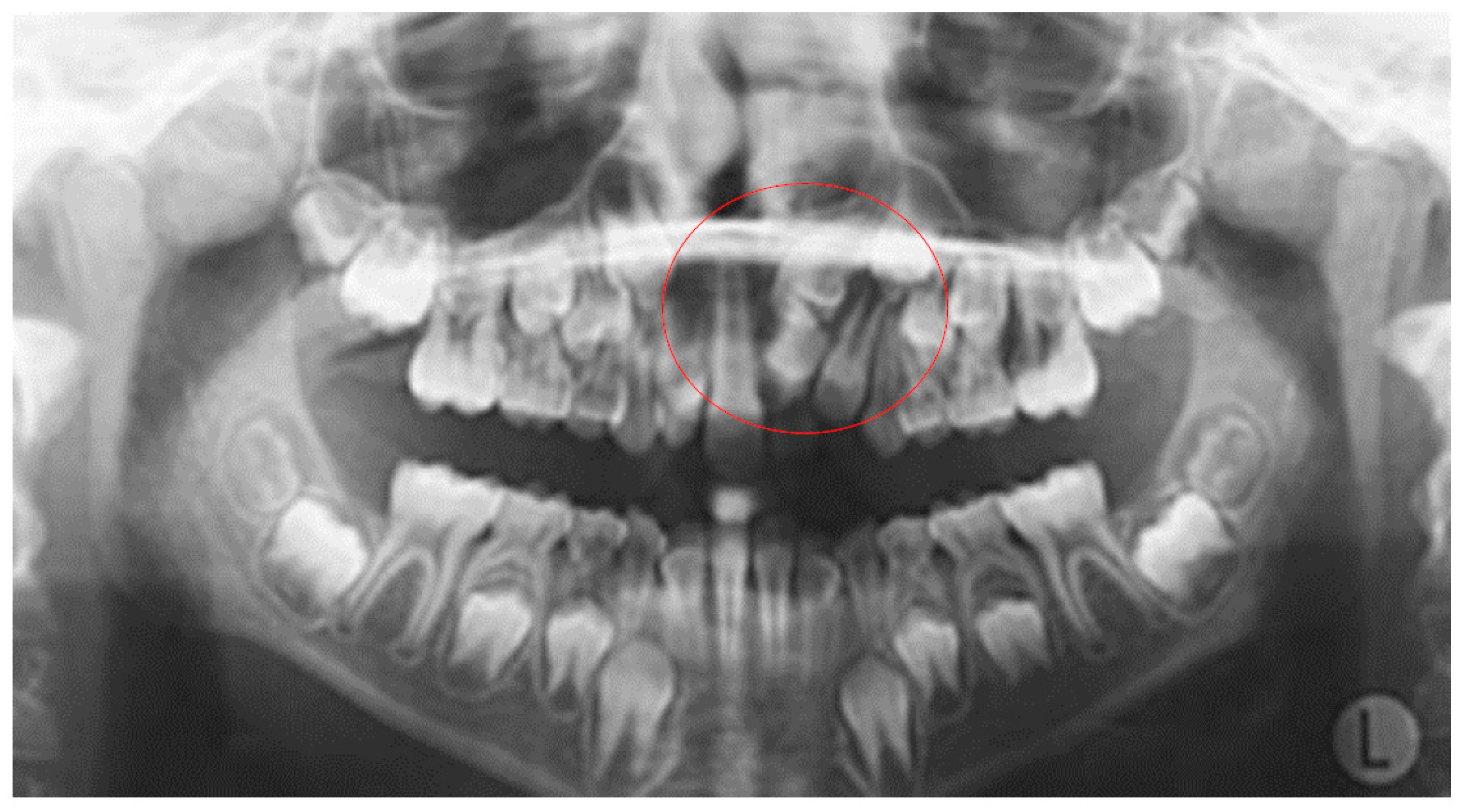 Dentistry 10 00150 g004 Dentistry 10 00150 g004