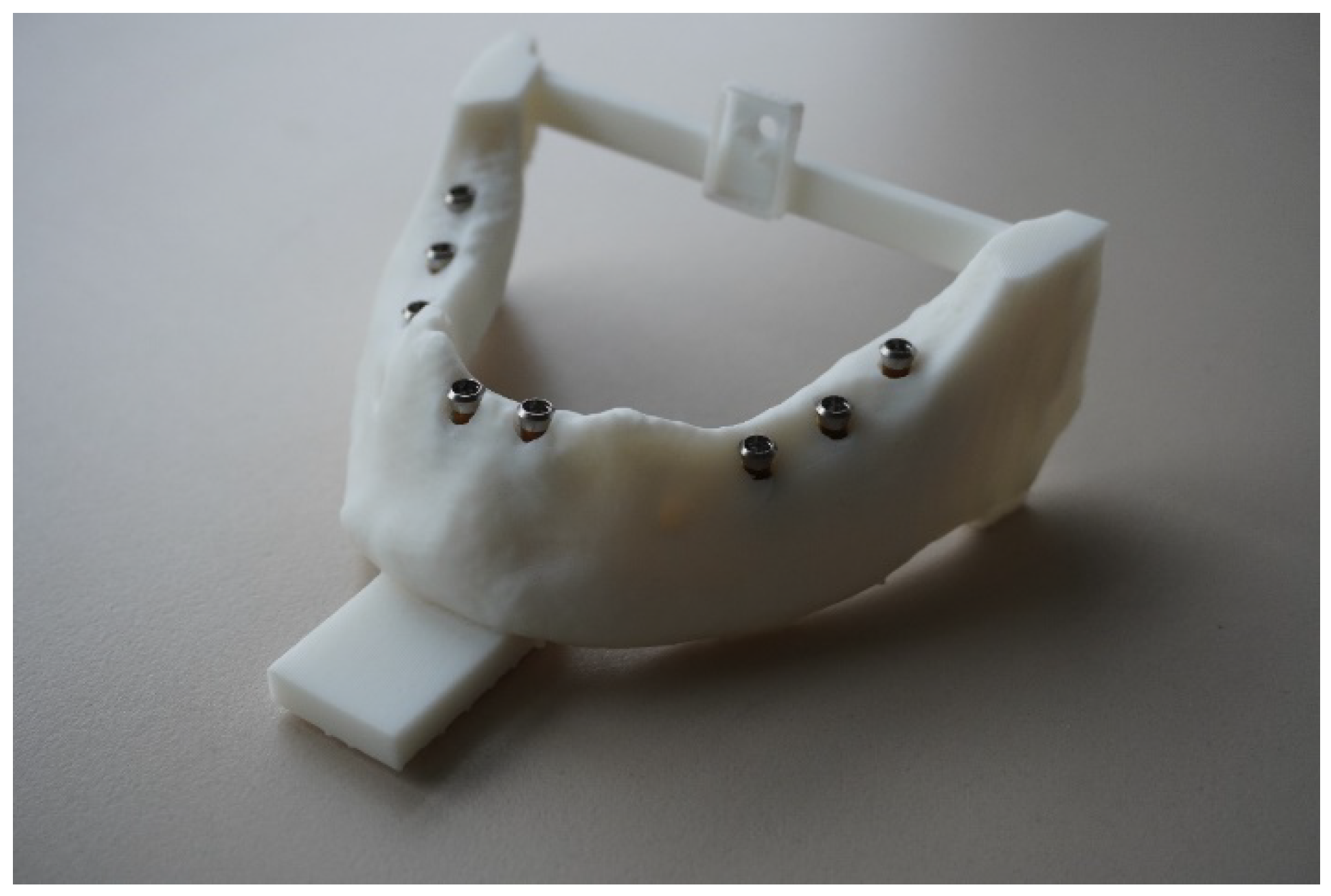 Dentistry 10 00187 g001 Dentistry 10 00187 g001