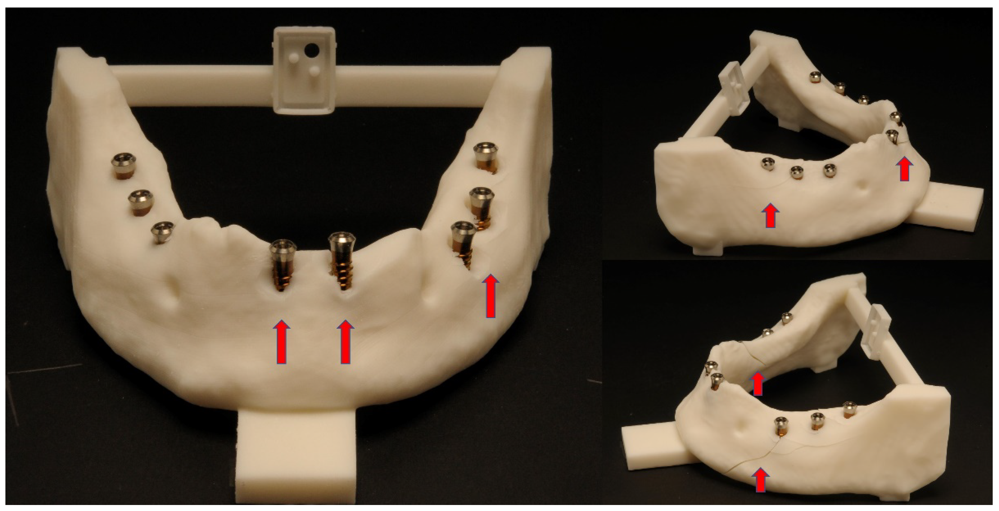 Dentistry 10 00187 g007 Dentistry 10 00187 g007