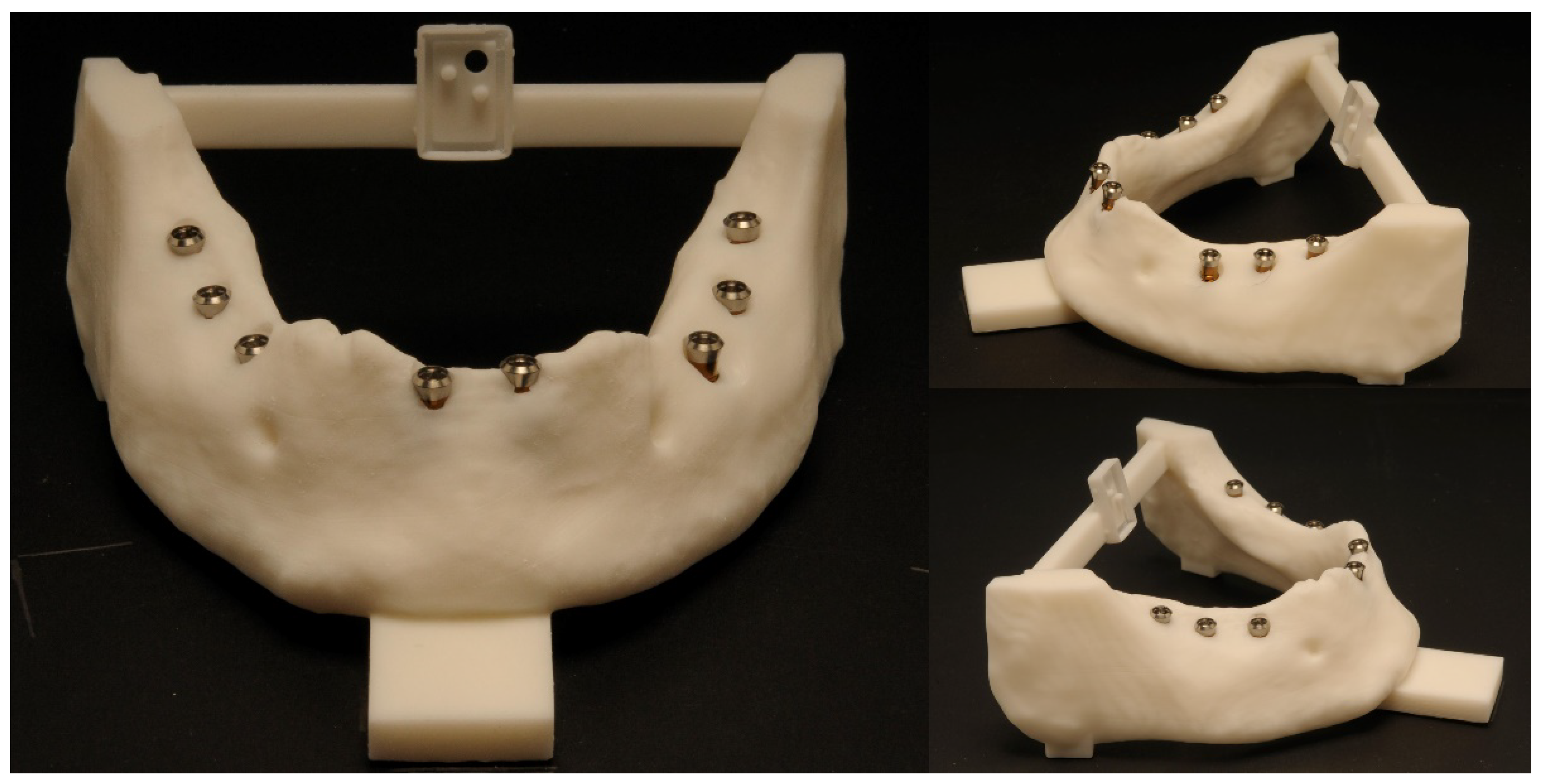 Dentistry 10 00187 g008 Dentistry 10 00187 g008