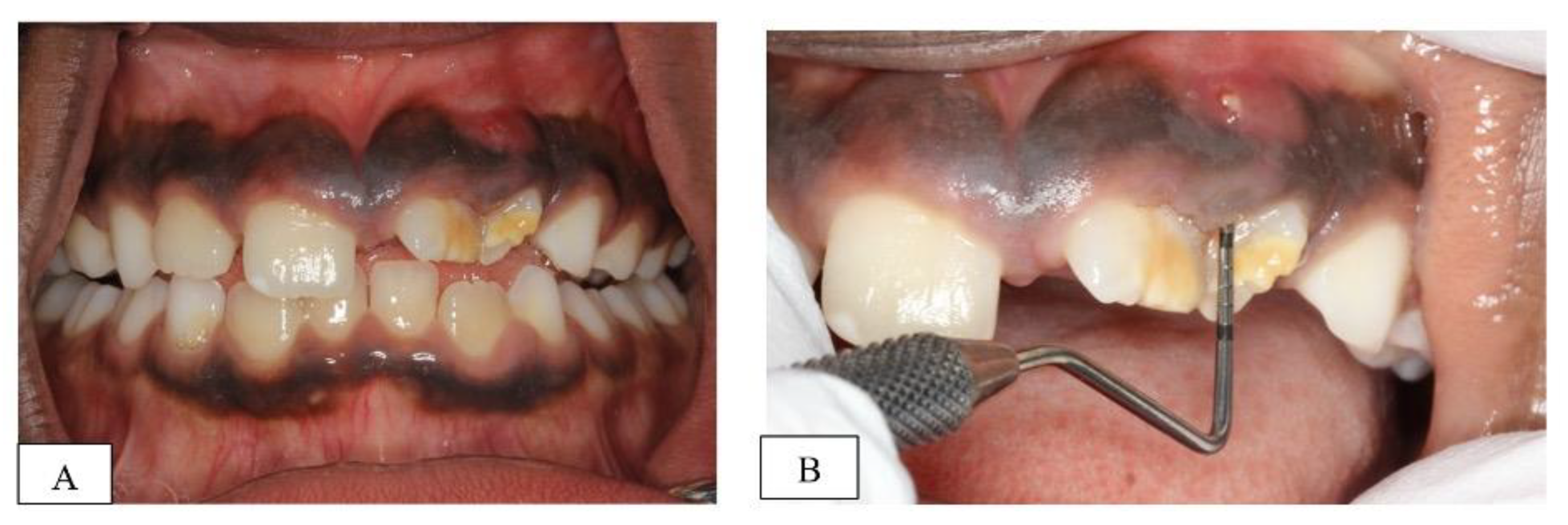 Dentistry 10 00202 g001 Dentistry 10 00202 g001