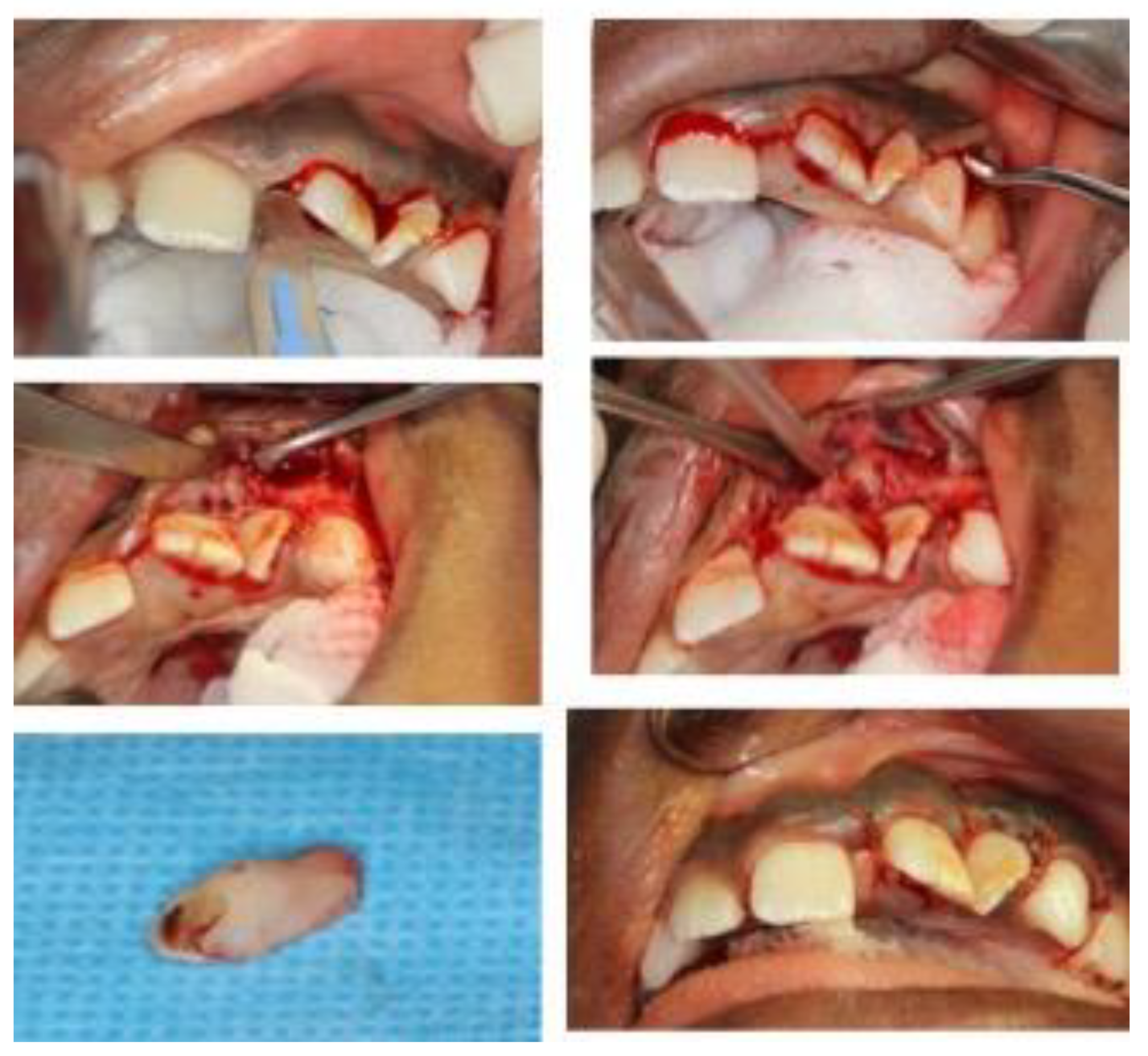 Dentistry 10 00202 g003 Dentistry 10 00202 g003