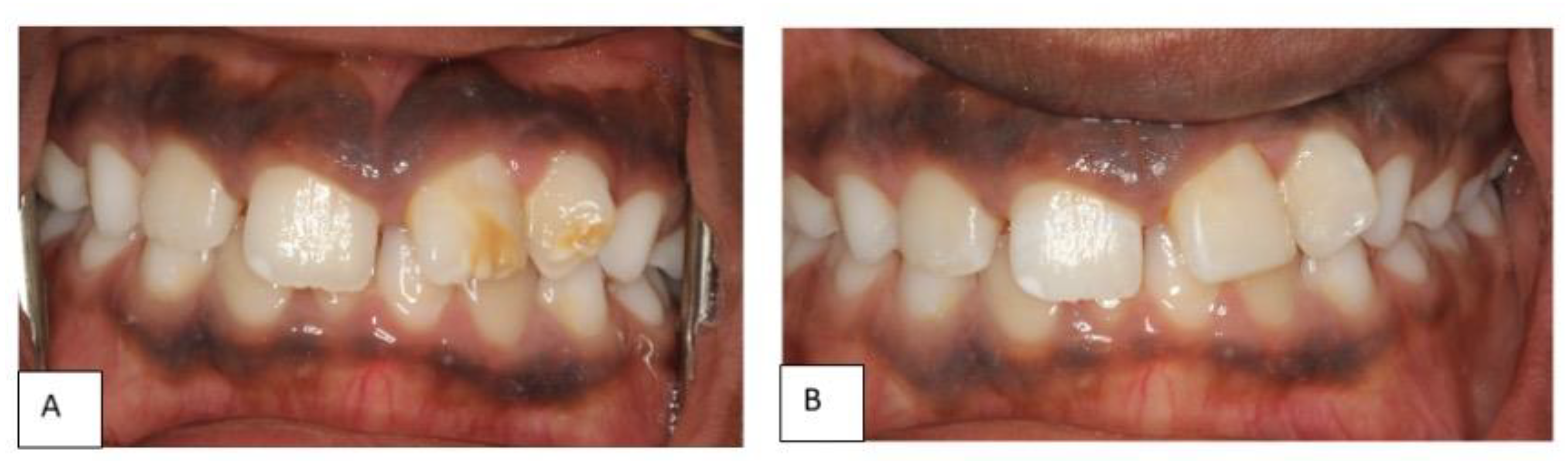 Dentistry 10 00202 g005 Dentistry 10 00202 g005