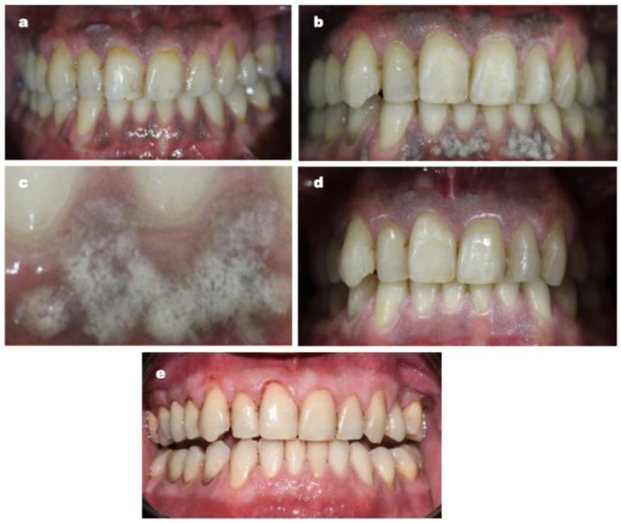 Dentistry 11 00002 g001