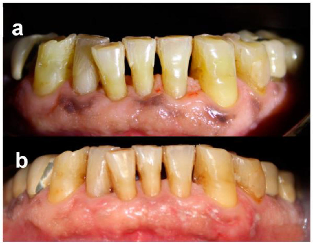 Dentistry 11 00002 g002