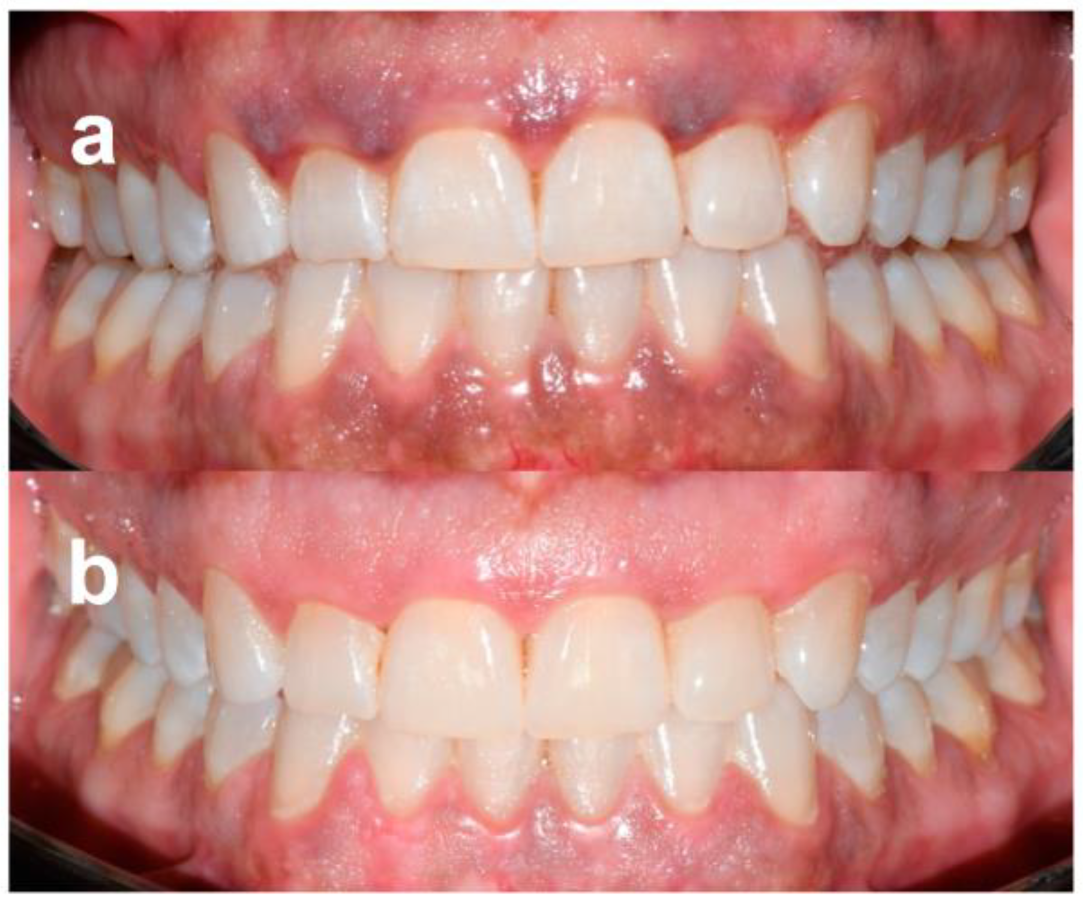 Dentistry 11 00002 g003